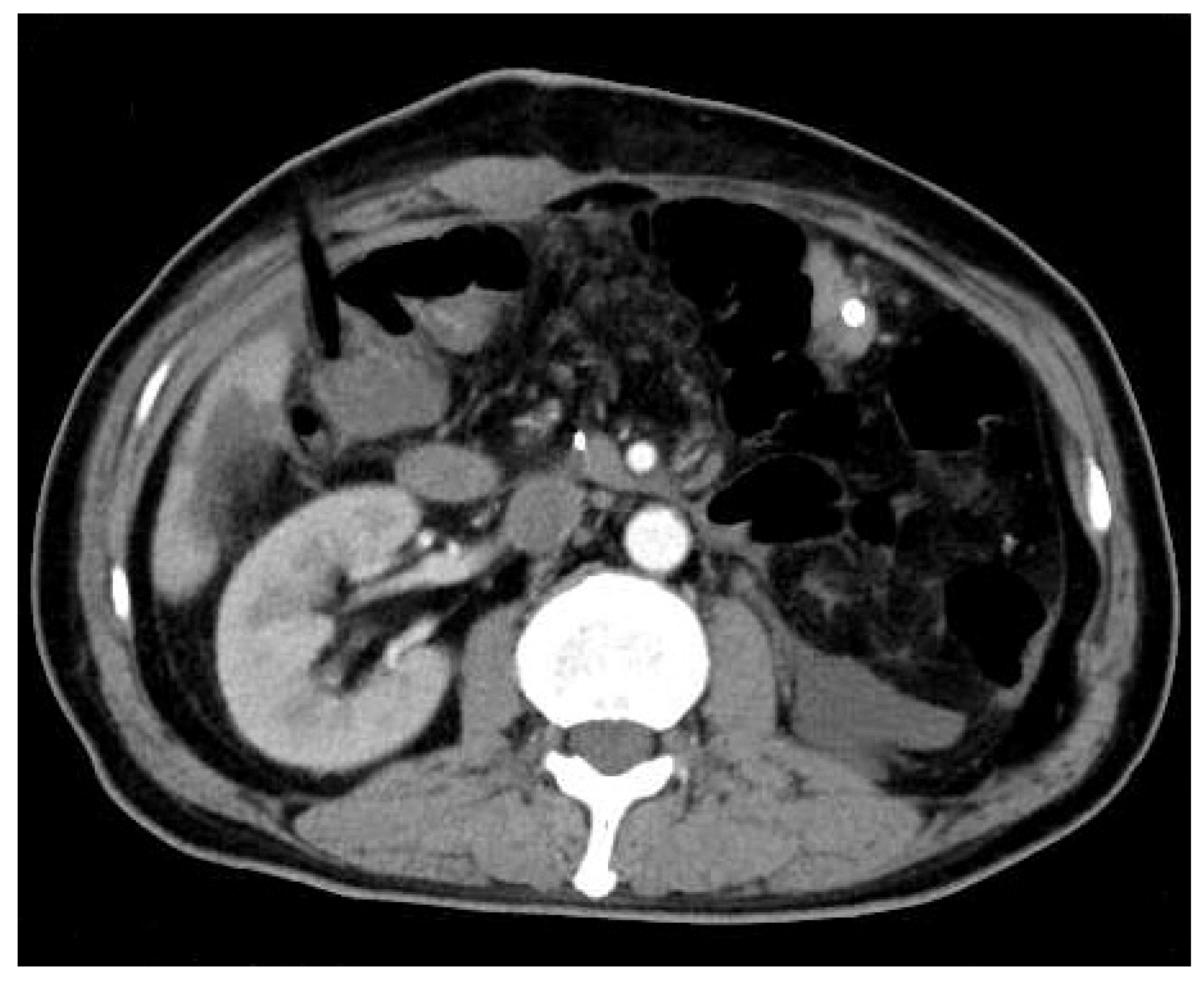 Diagnostics 12 00571 g004