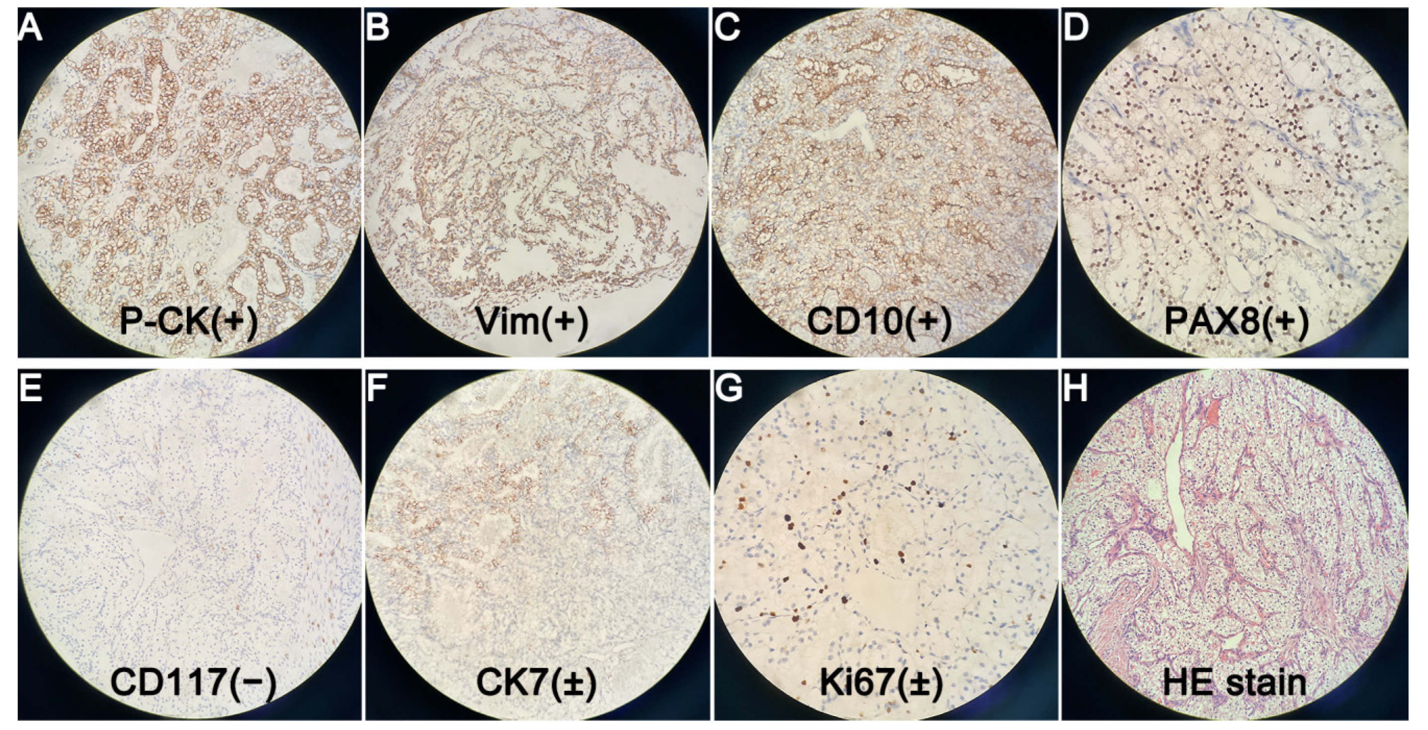 Diagnostics 12 00571 g005
