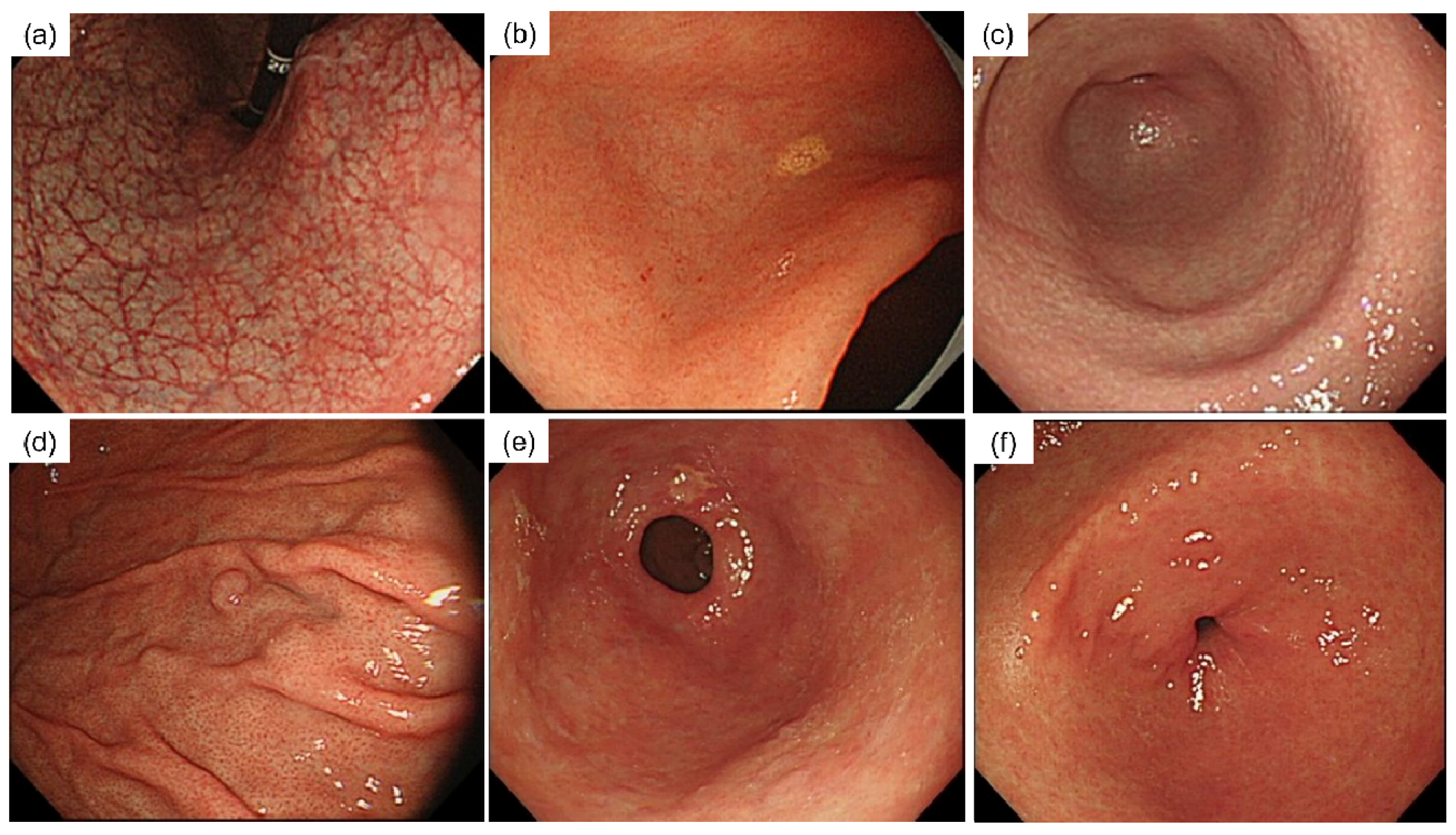 Diagnostics 12 00572 g001