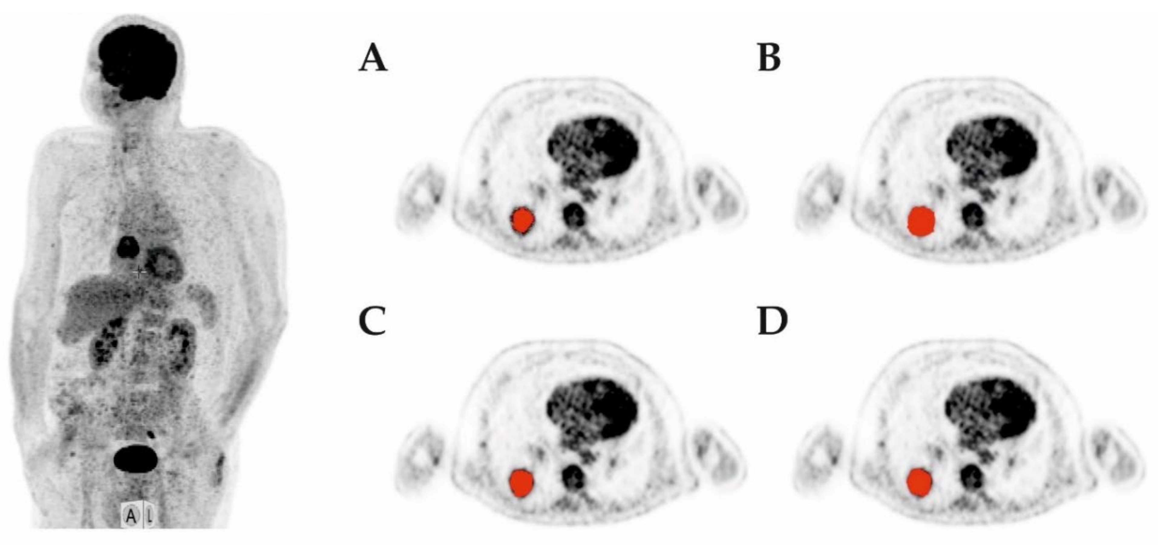 Diagnostics 12 00576 g003 Diagnostics 12 00576 g003
