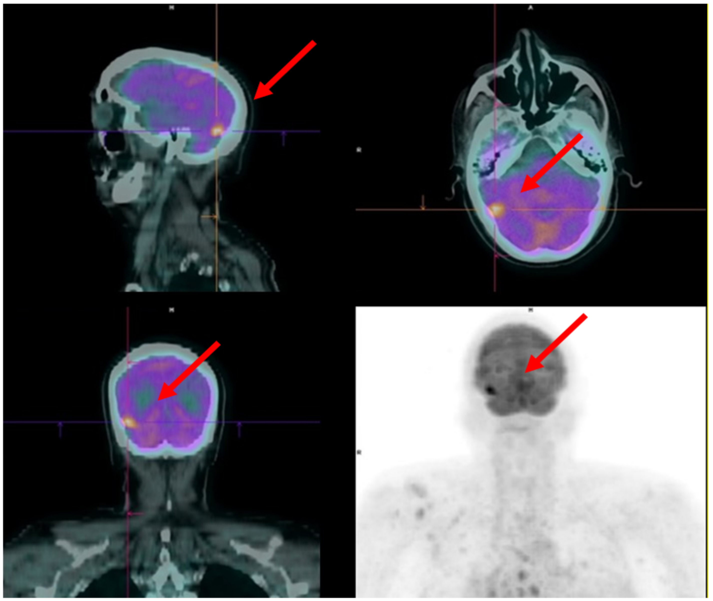 Diagnostics 12 00581 g005 Diagnostics 12 00581 g005