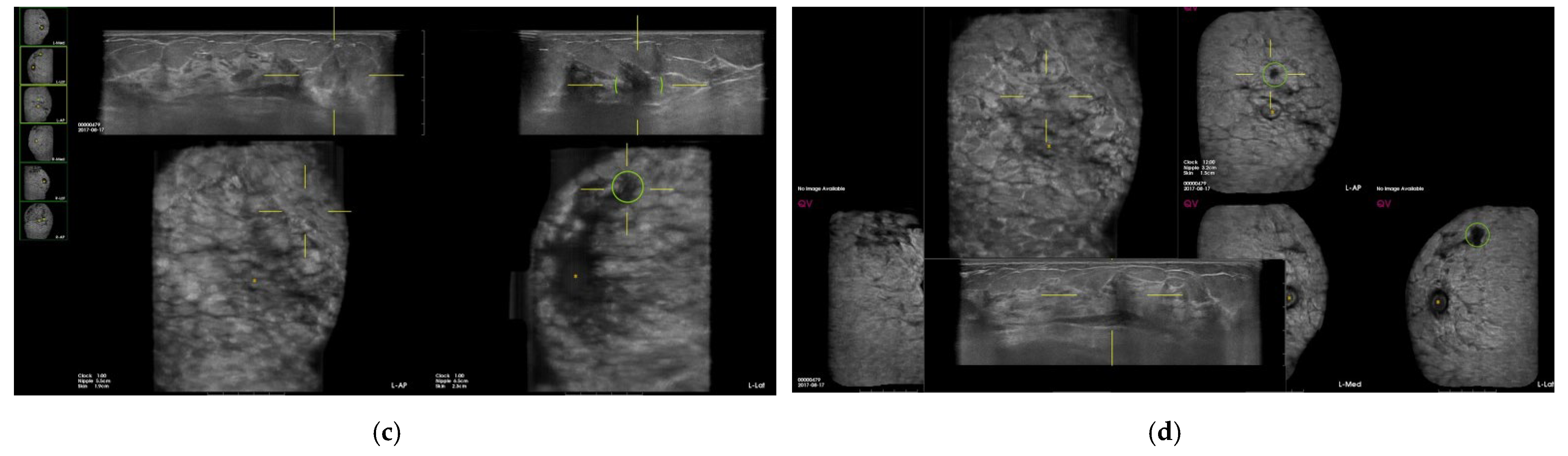 Diagnostics 12 00583 g002b