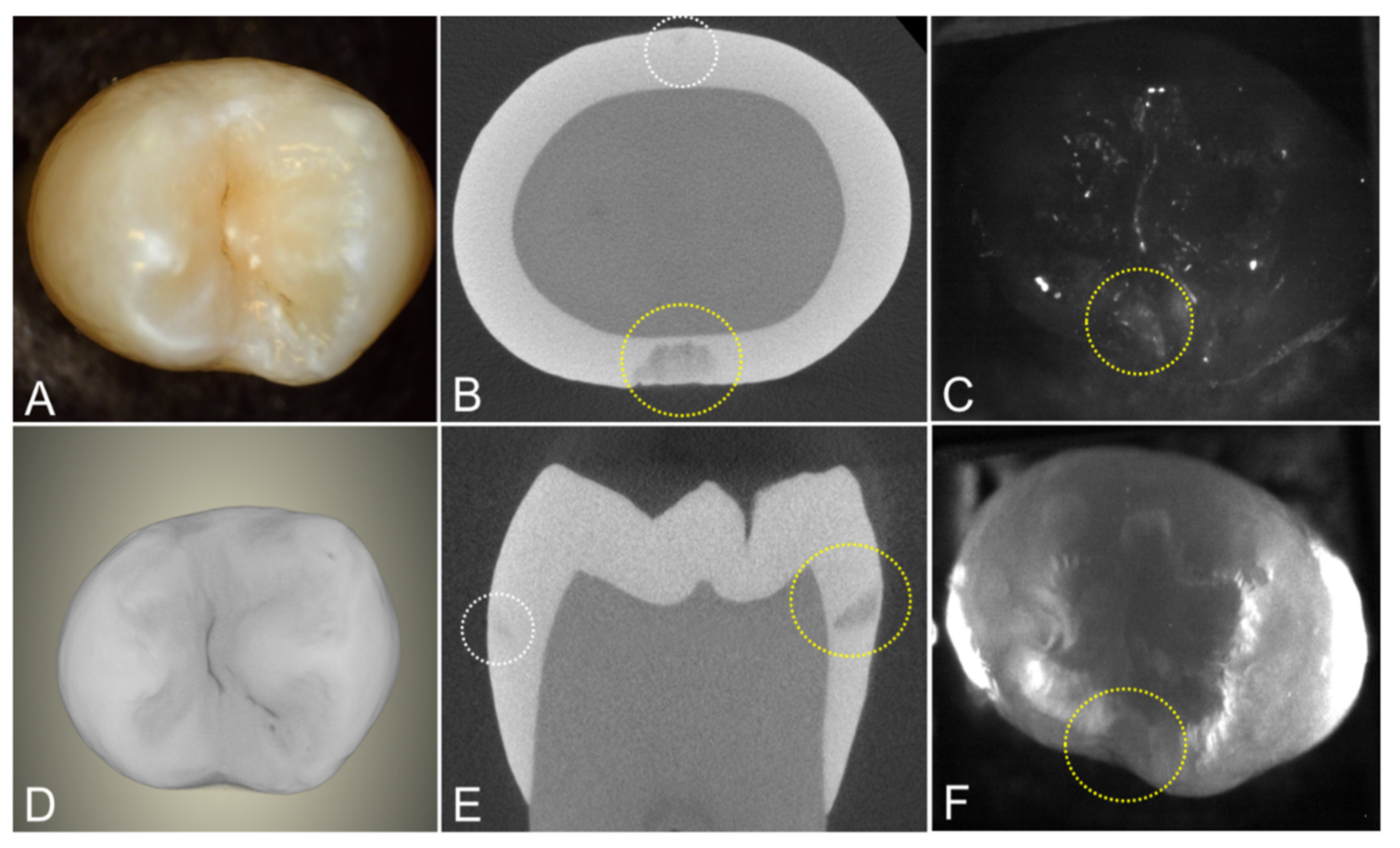 Diagnostics 12 00597 g004