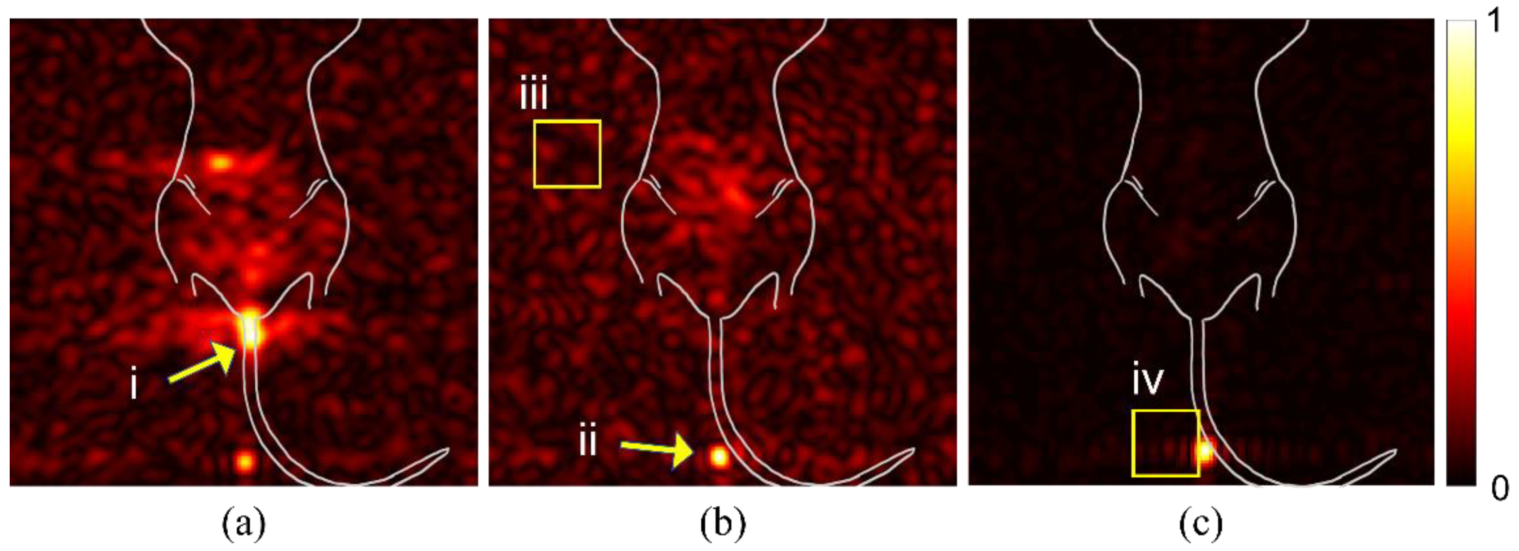 Diagnostics 12 00610 g001 550