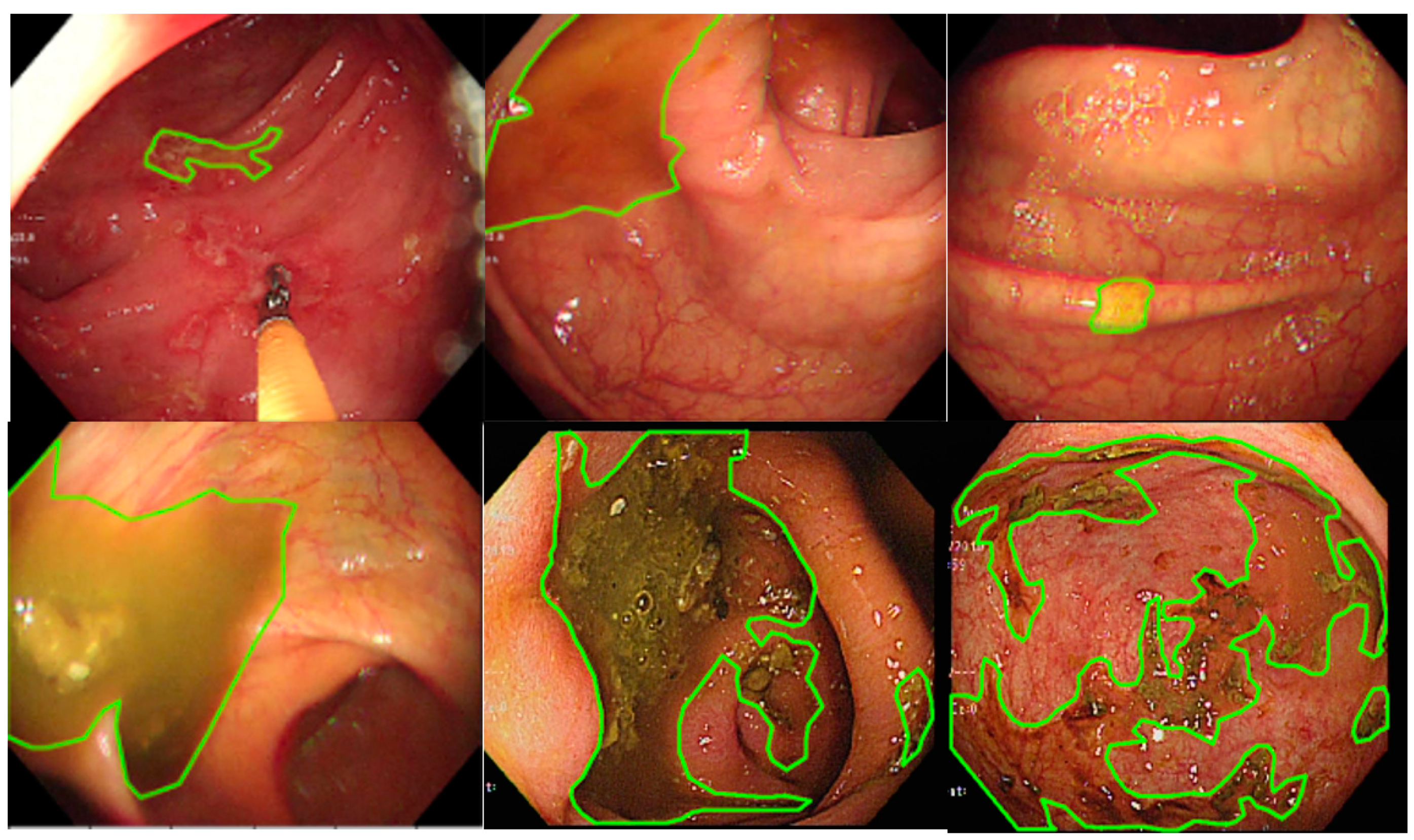 Diagnostics 12 00613 g001 550