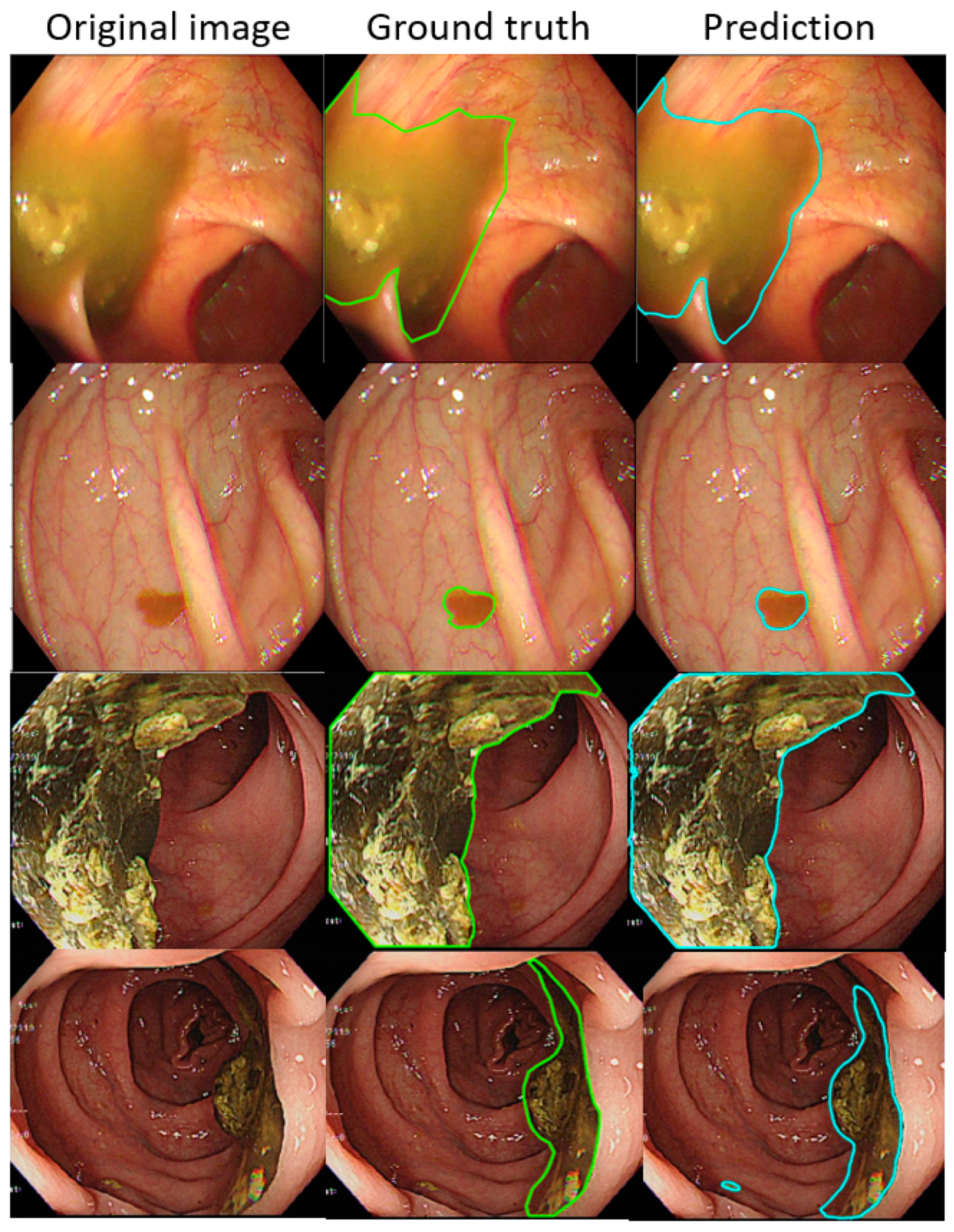 Diagnostics 12 00613 g004 550