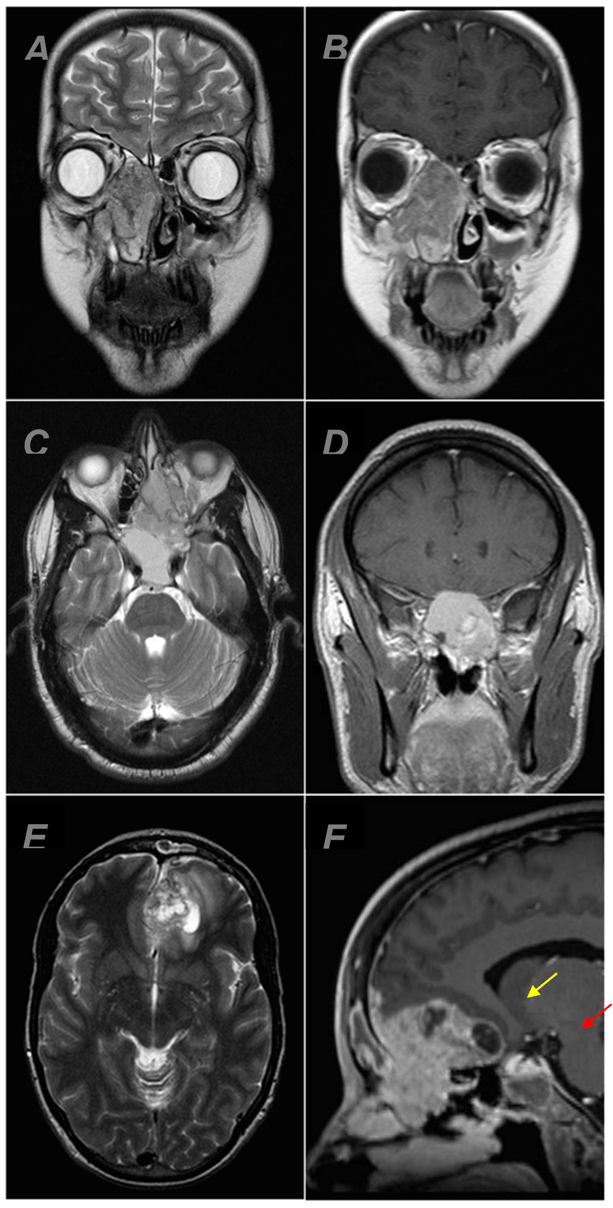 Diagnostics 12 00614 g001