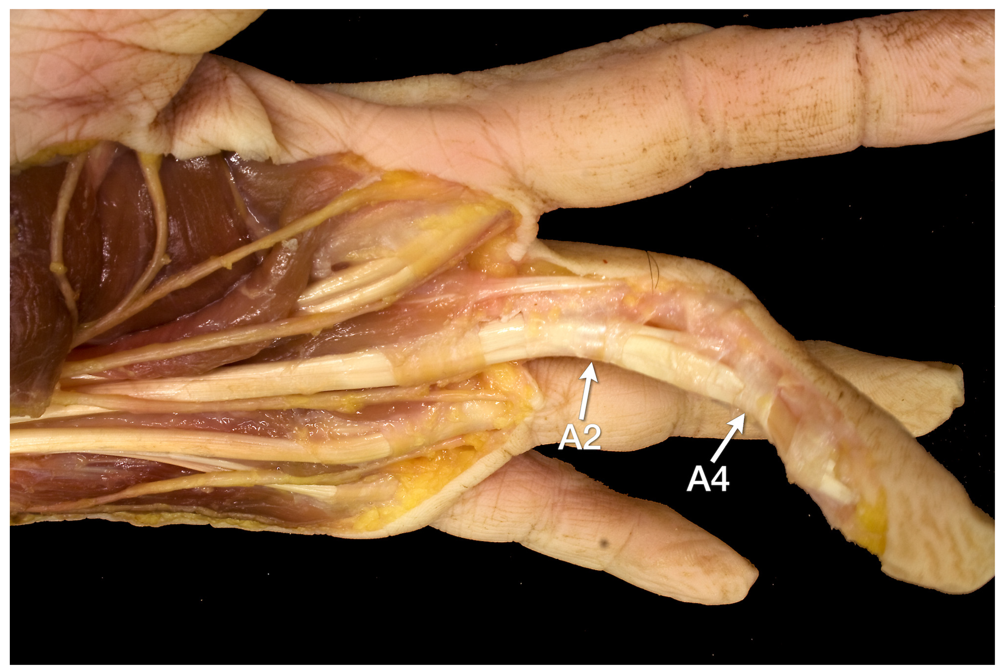 Diagnostics 12 00618 g001