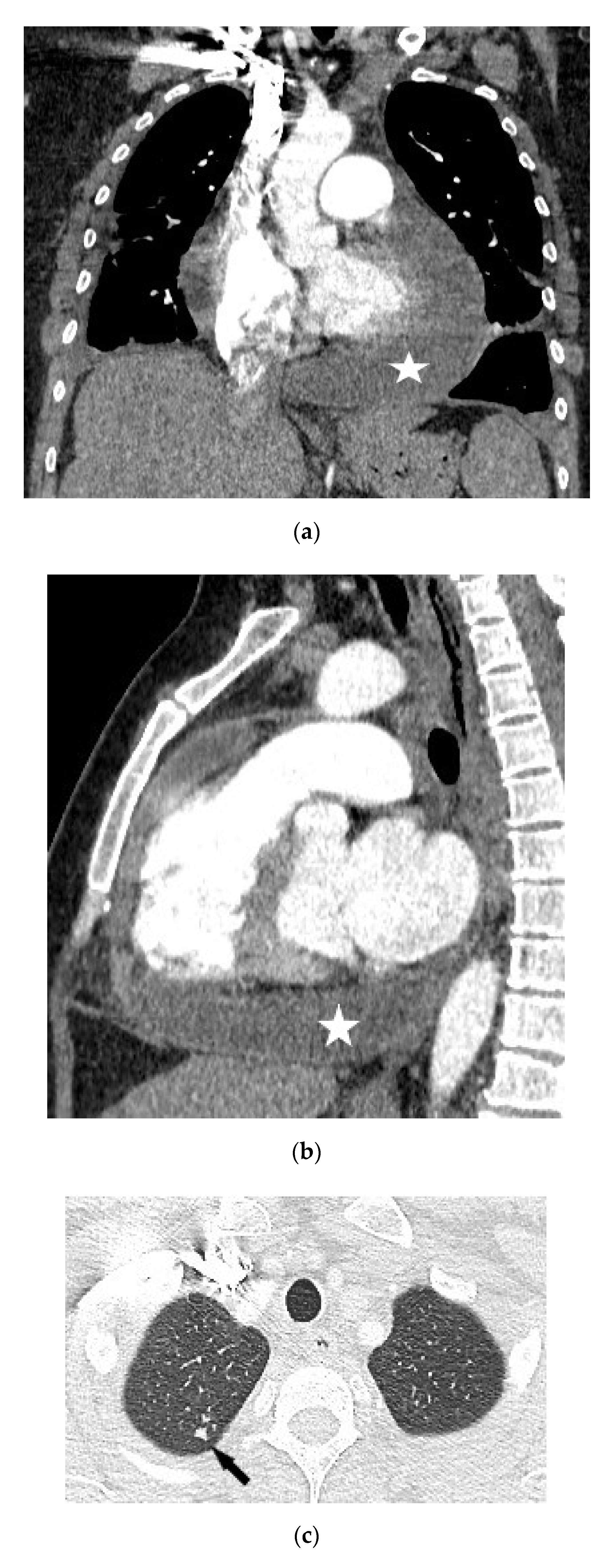 Diagnostics 12 00619 g002a 550