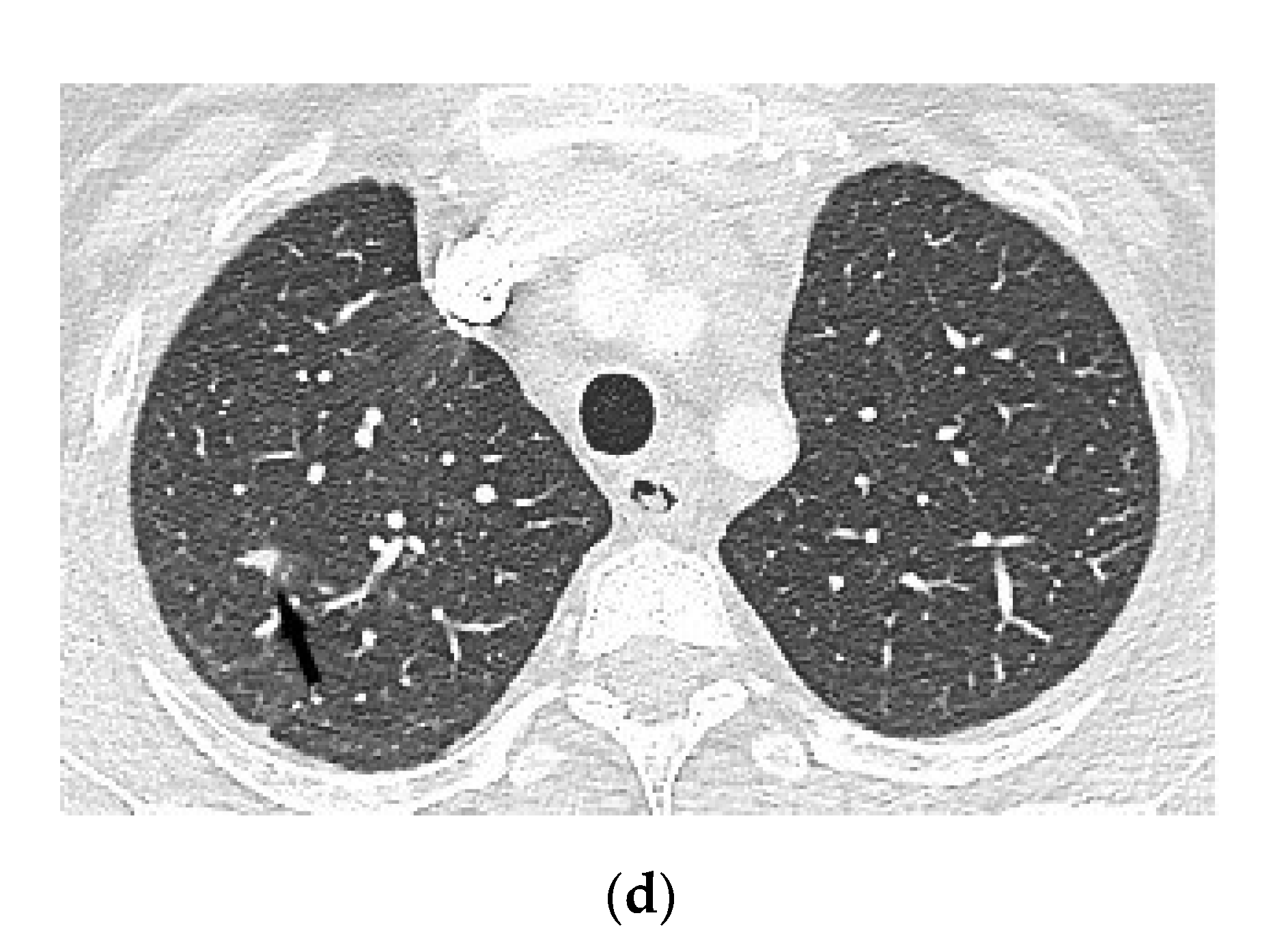 Diagnostics 12 00619 g002b 550