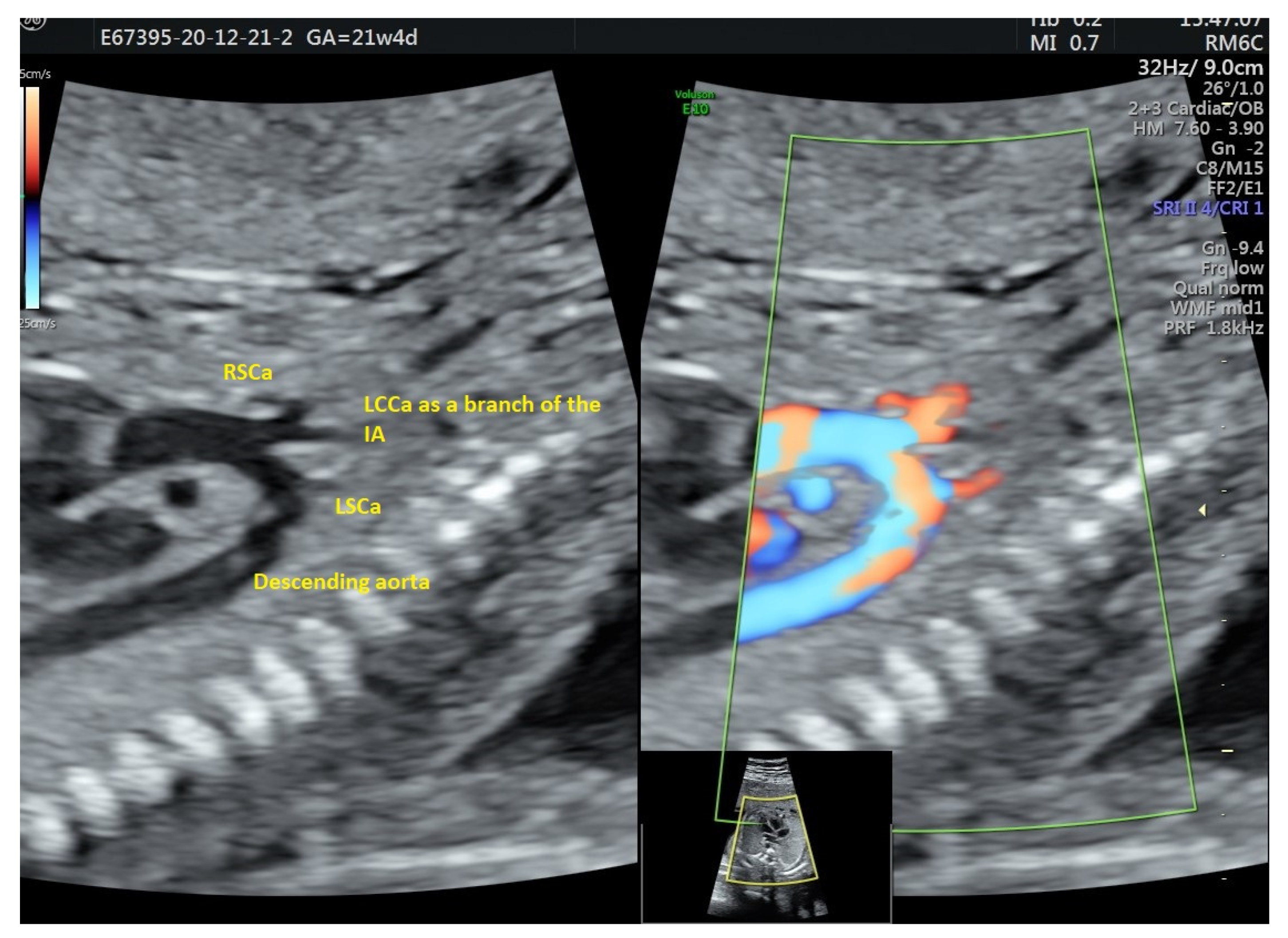 Diagnostics 12 00624 g005