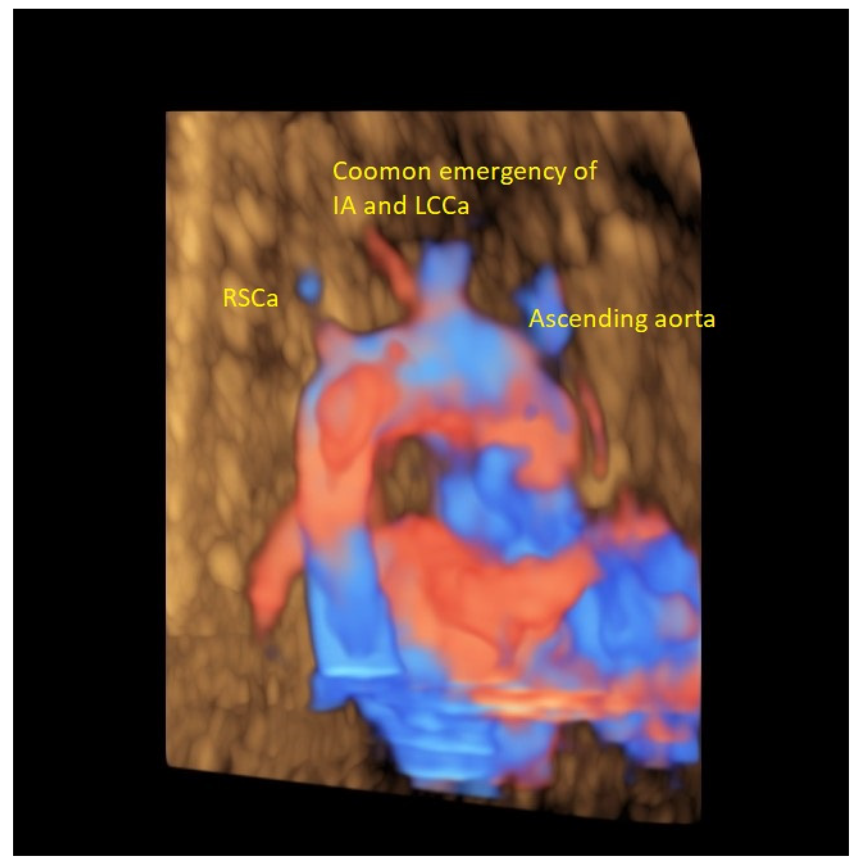 Diagnostics 12 00624 g006