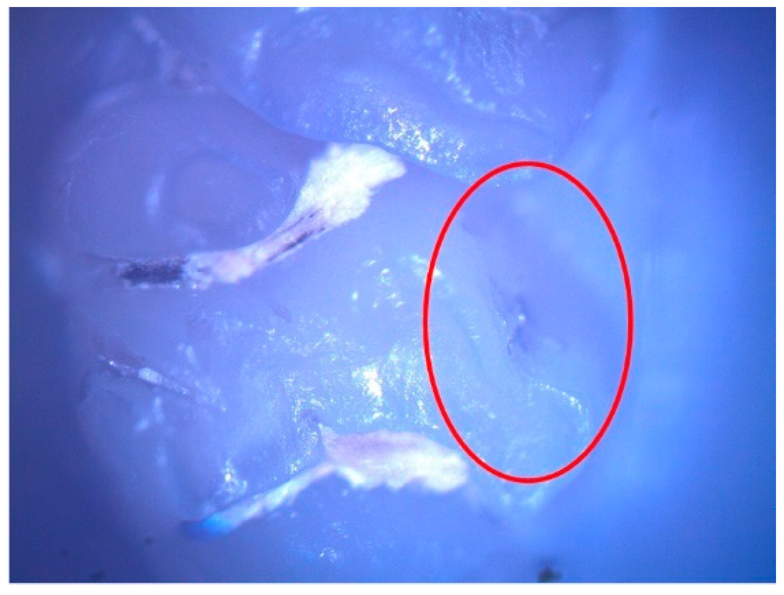 Diagnostics 12 00636 g003 550