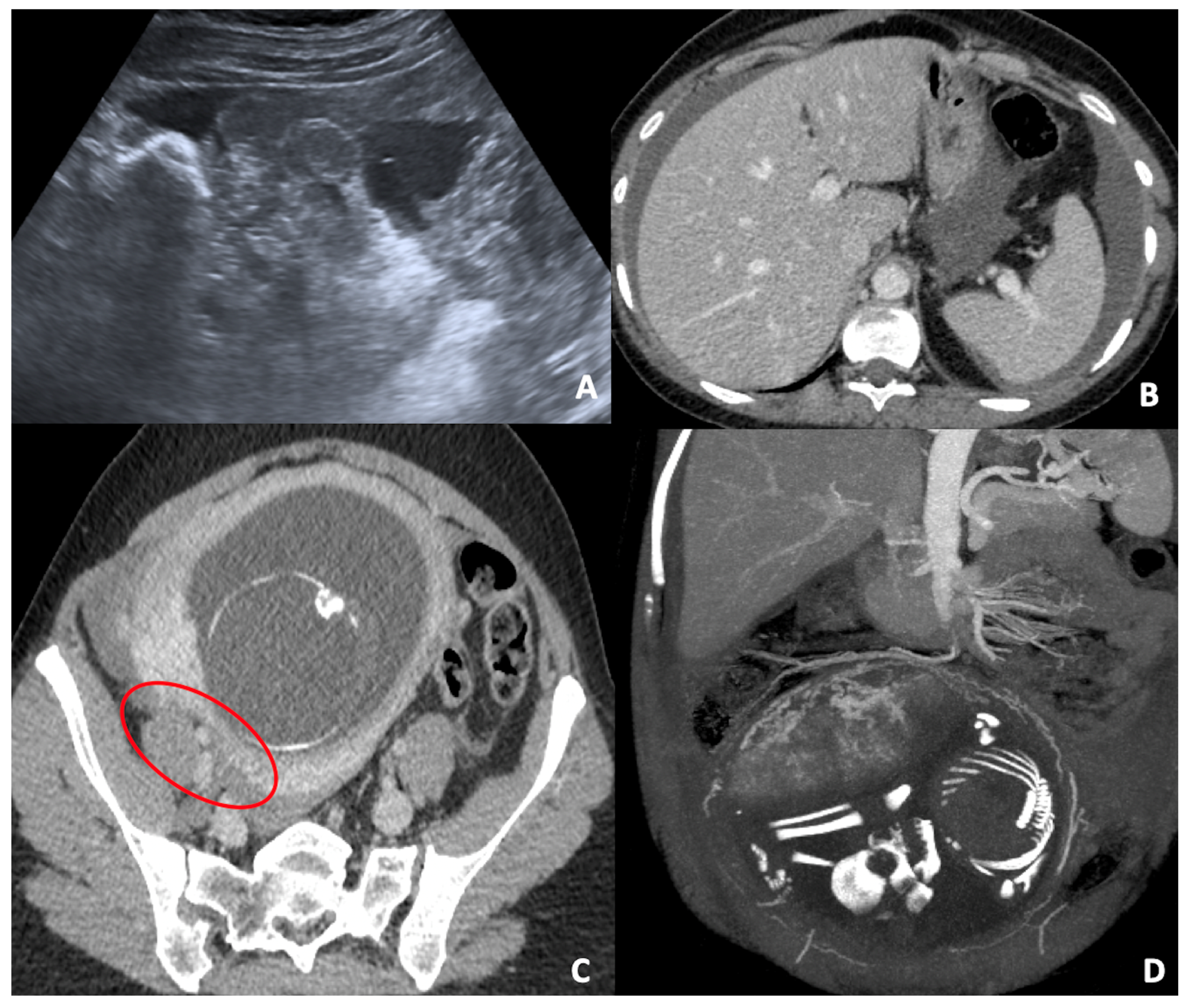 Diagnostics 12 00640 g004
