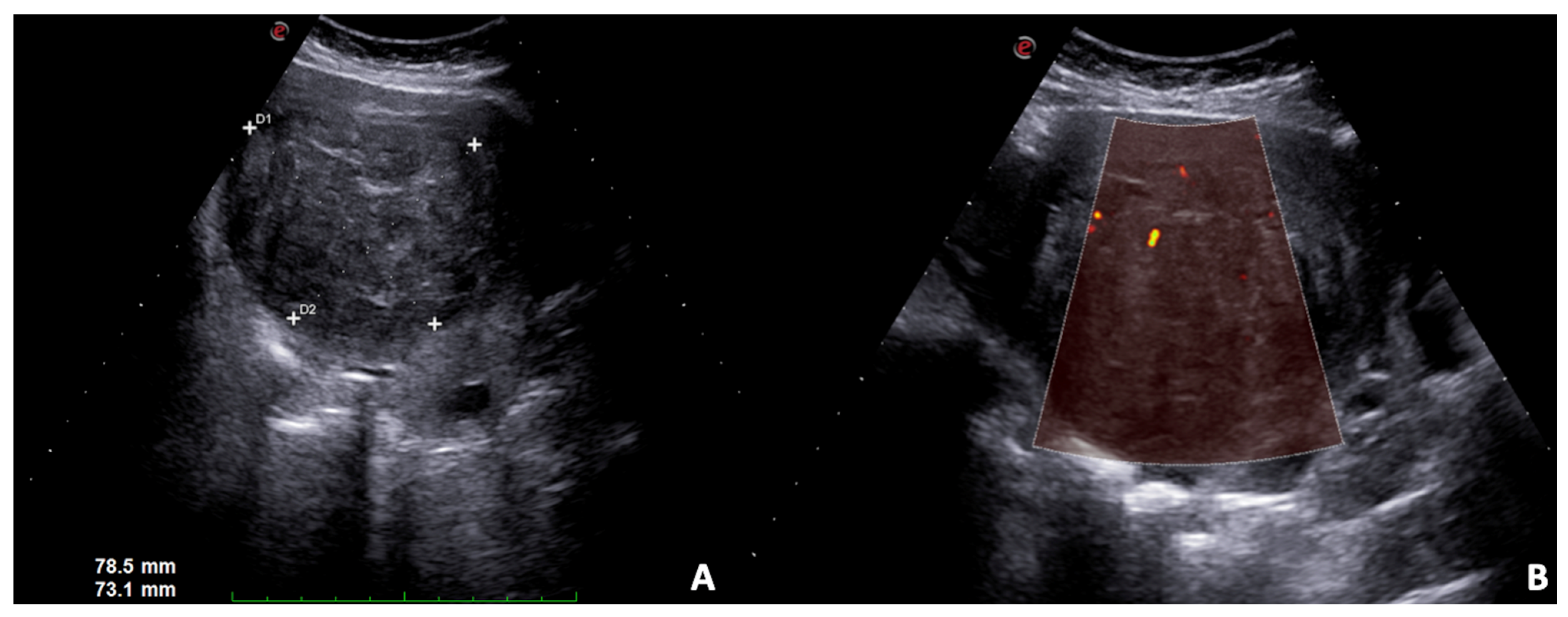 Diagnostics 12 00640 g005