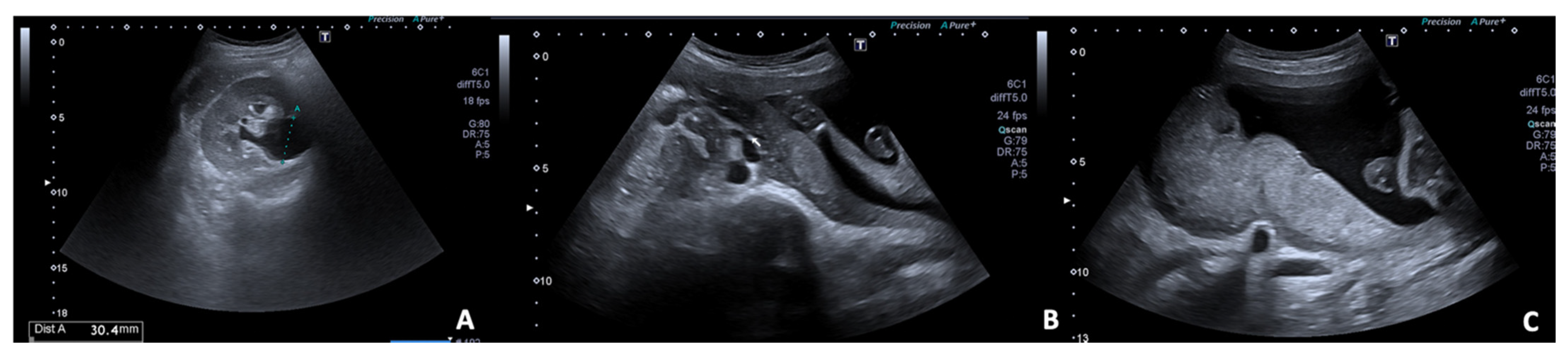 Diagnostics 12 00640 g006