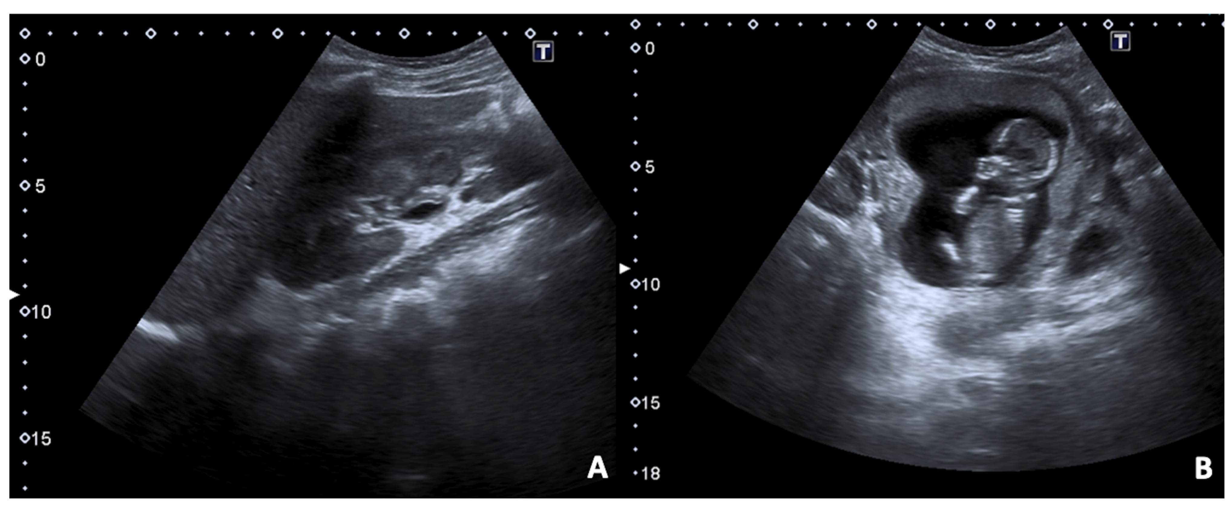 Diagnostics 12 00640 g010