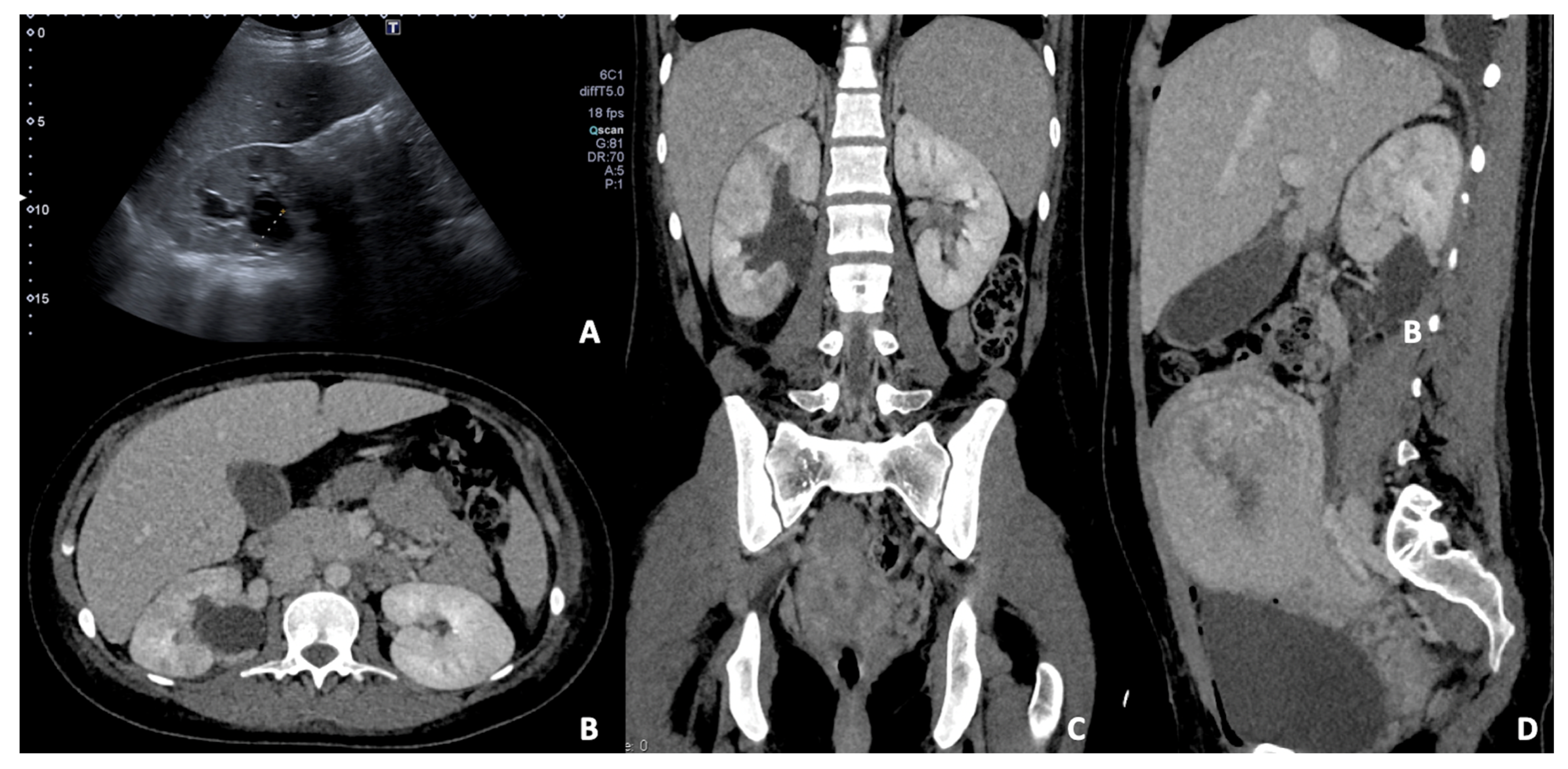 Diagnostics 12 00640 g011
