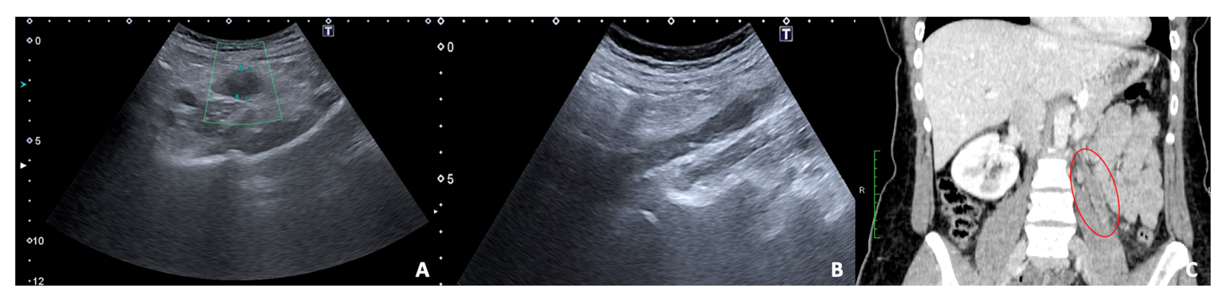 Diagnostics 12 00640 g013