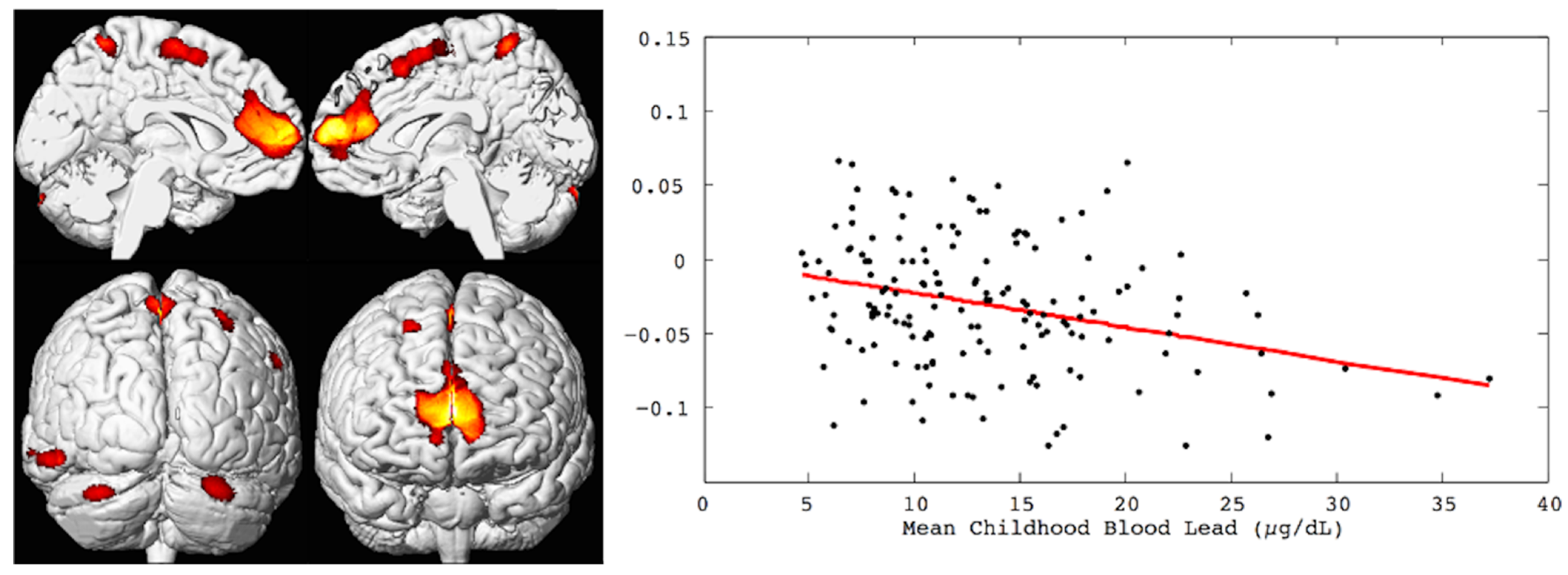 Reorganizations of latency structures within the white matter from