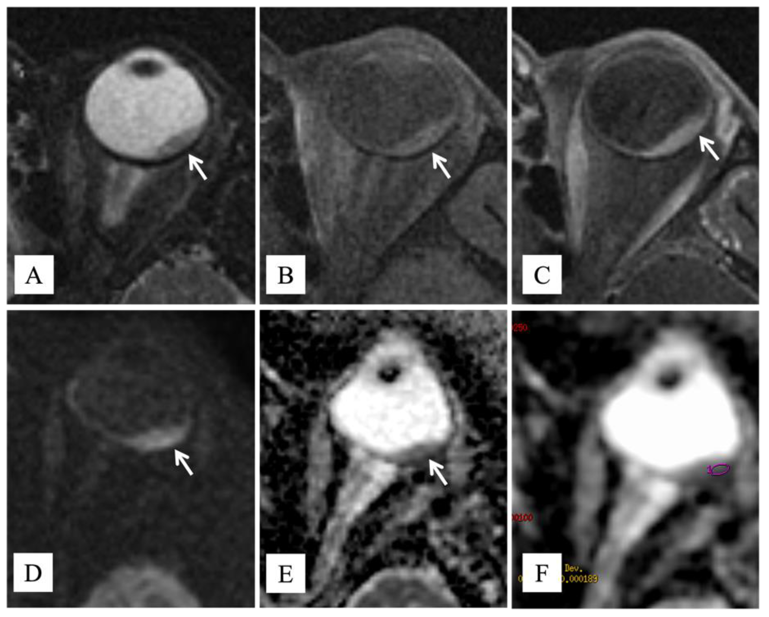 Diagnostics 12 00642 g001