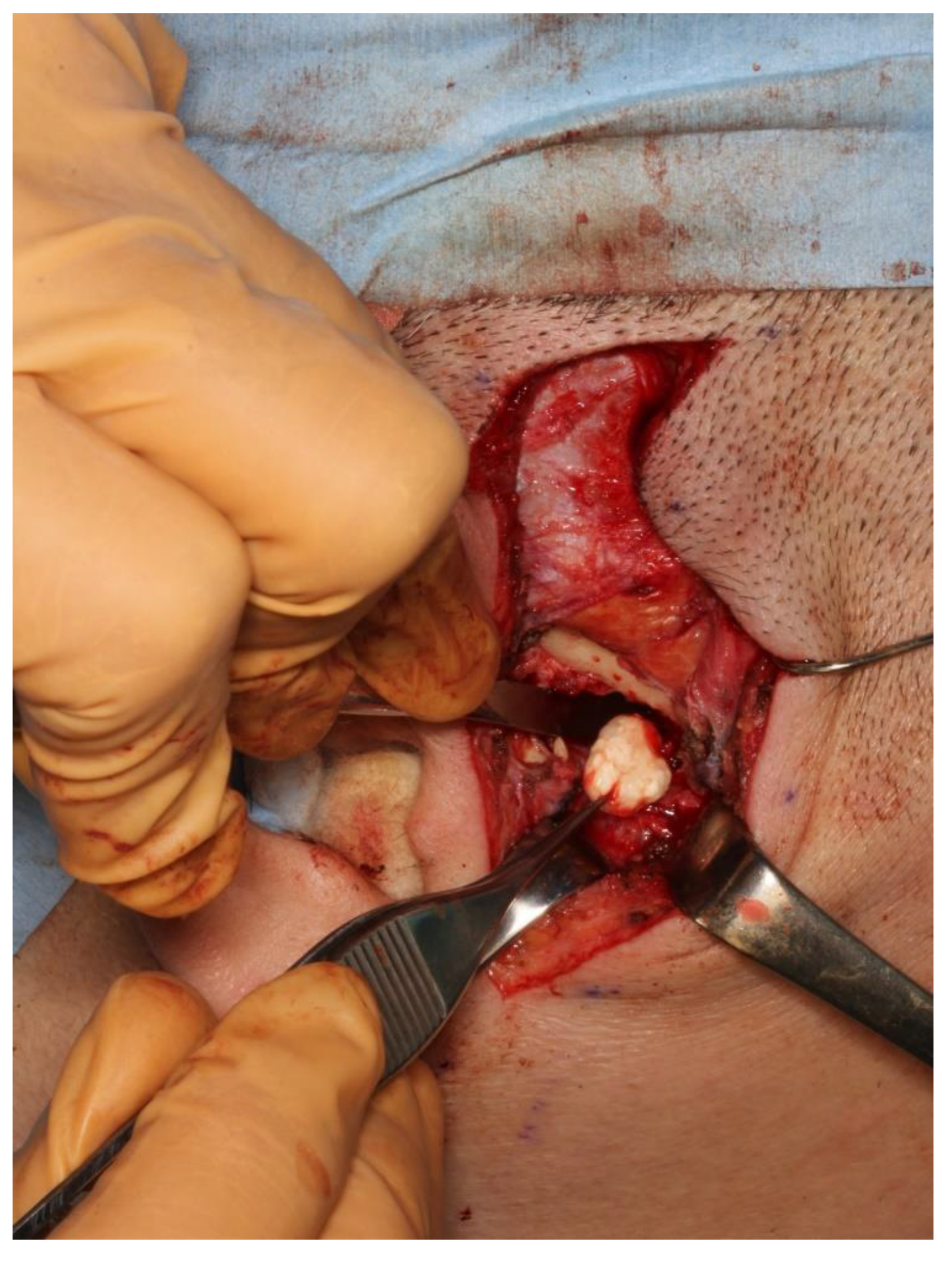 Diagnostics 12 00651 g004