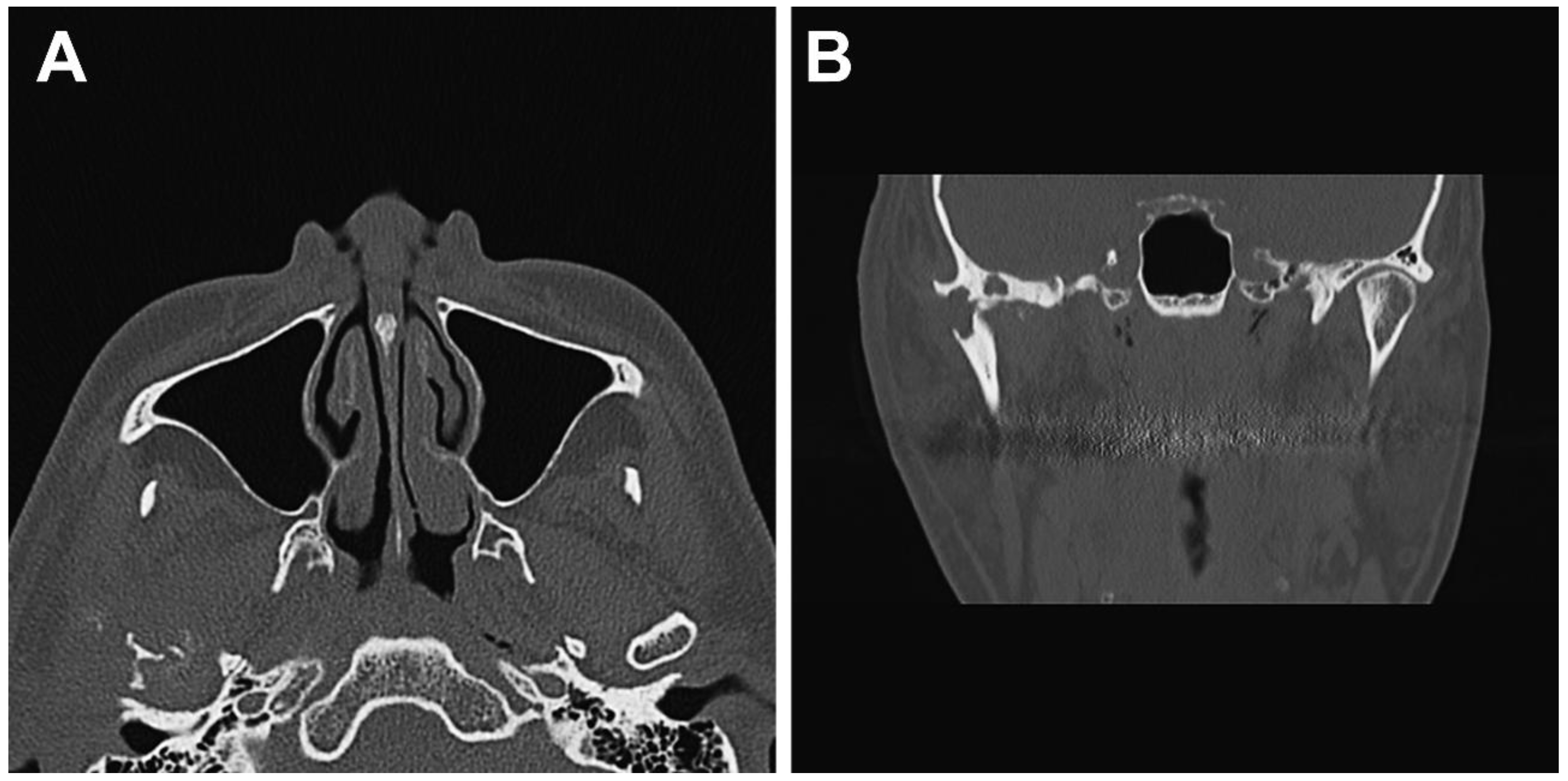 Diagnostics 12 00651 g005