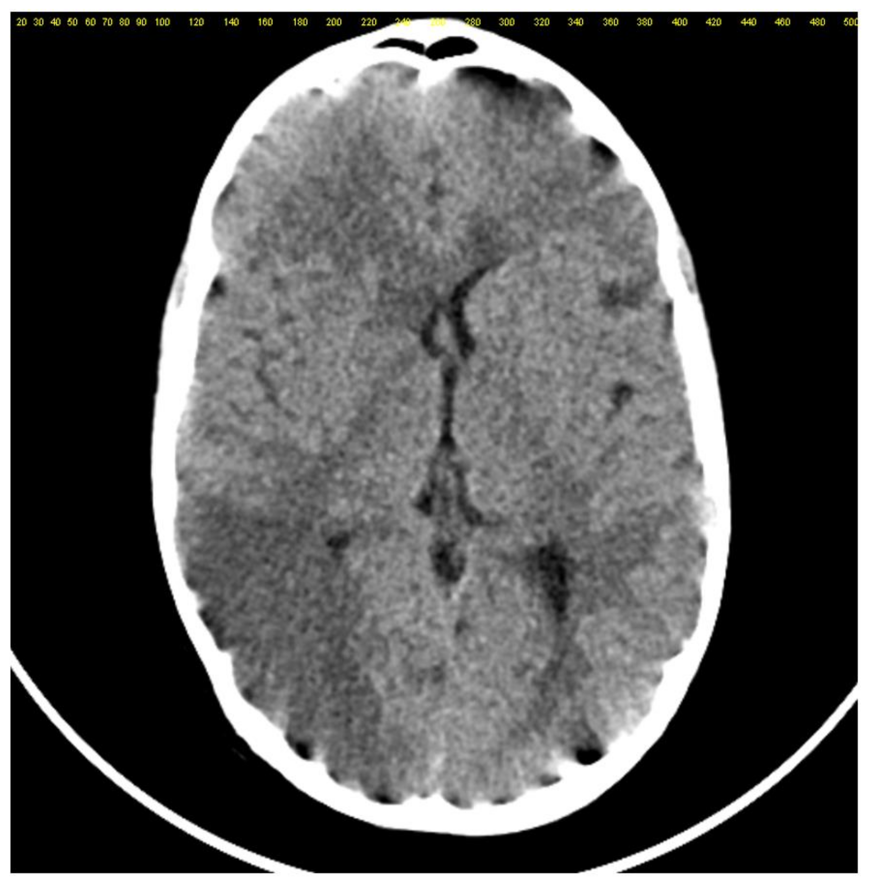 Diagnostics 12 00657 g001 Diagnostics 12 00657 g001