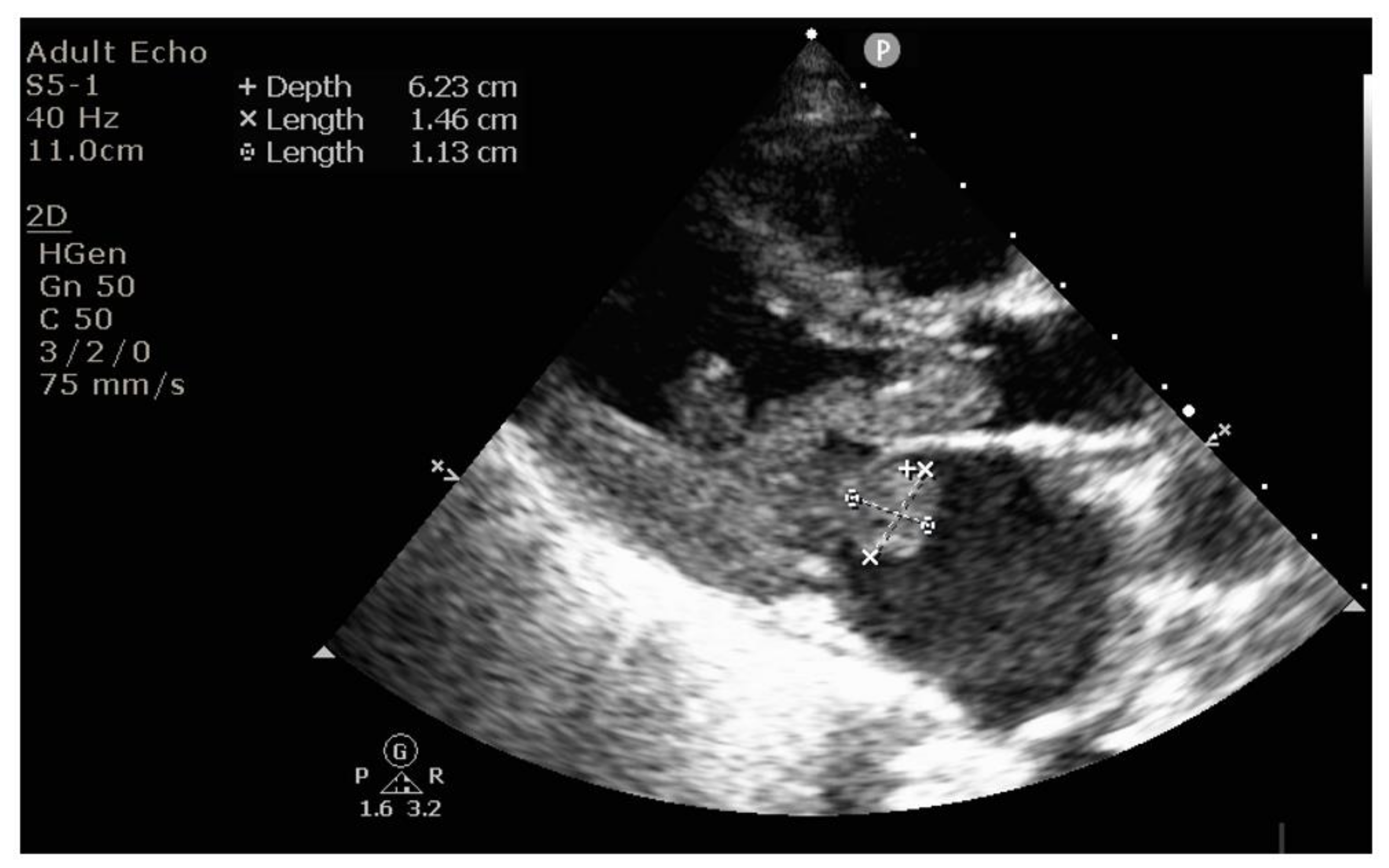 Diagnostics 12 00657 g004 Diagnostics 12 00657 g004