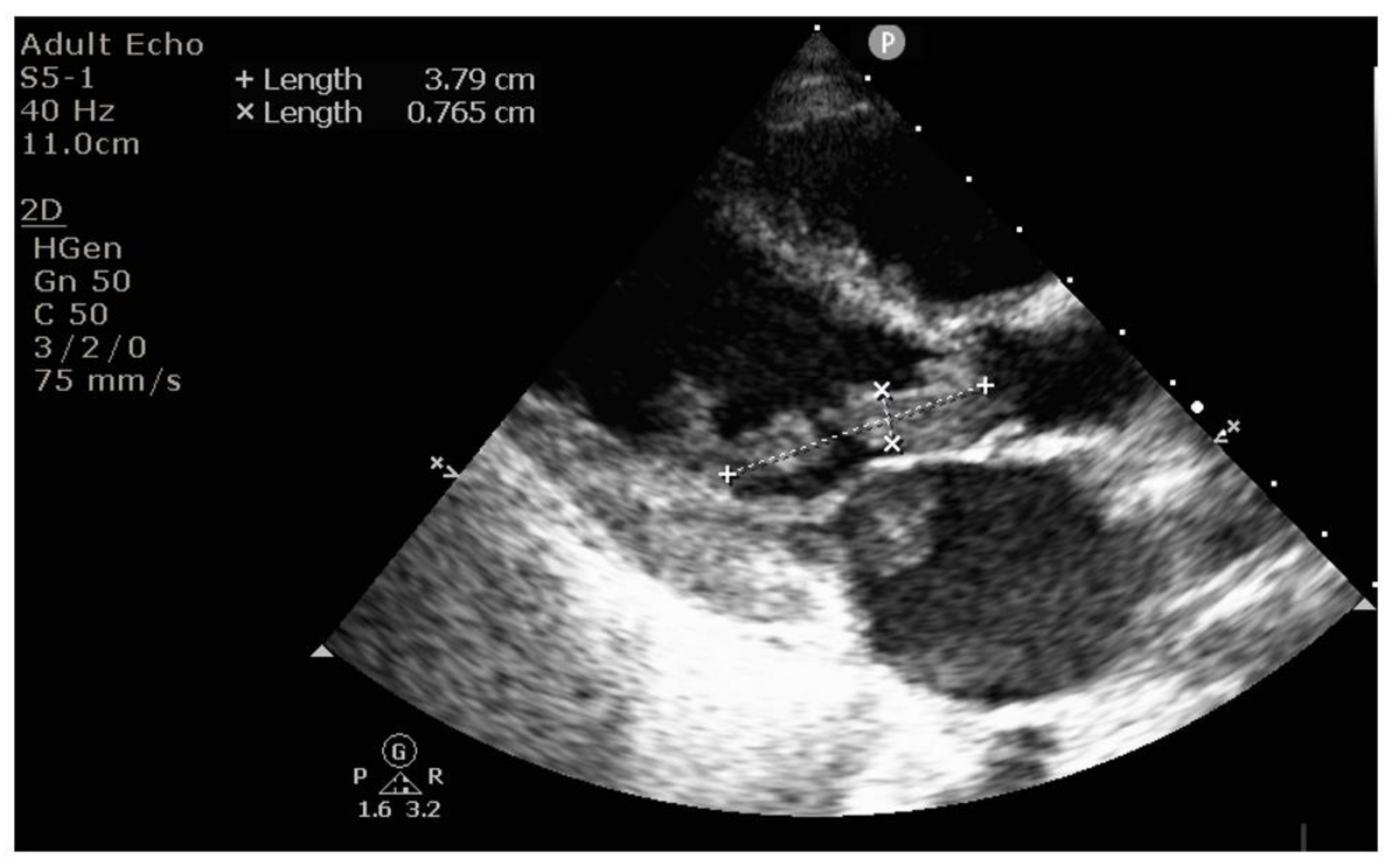 Diagnostics 12 00657 g005 Diagnostics 12 00657 g005