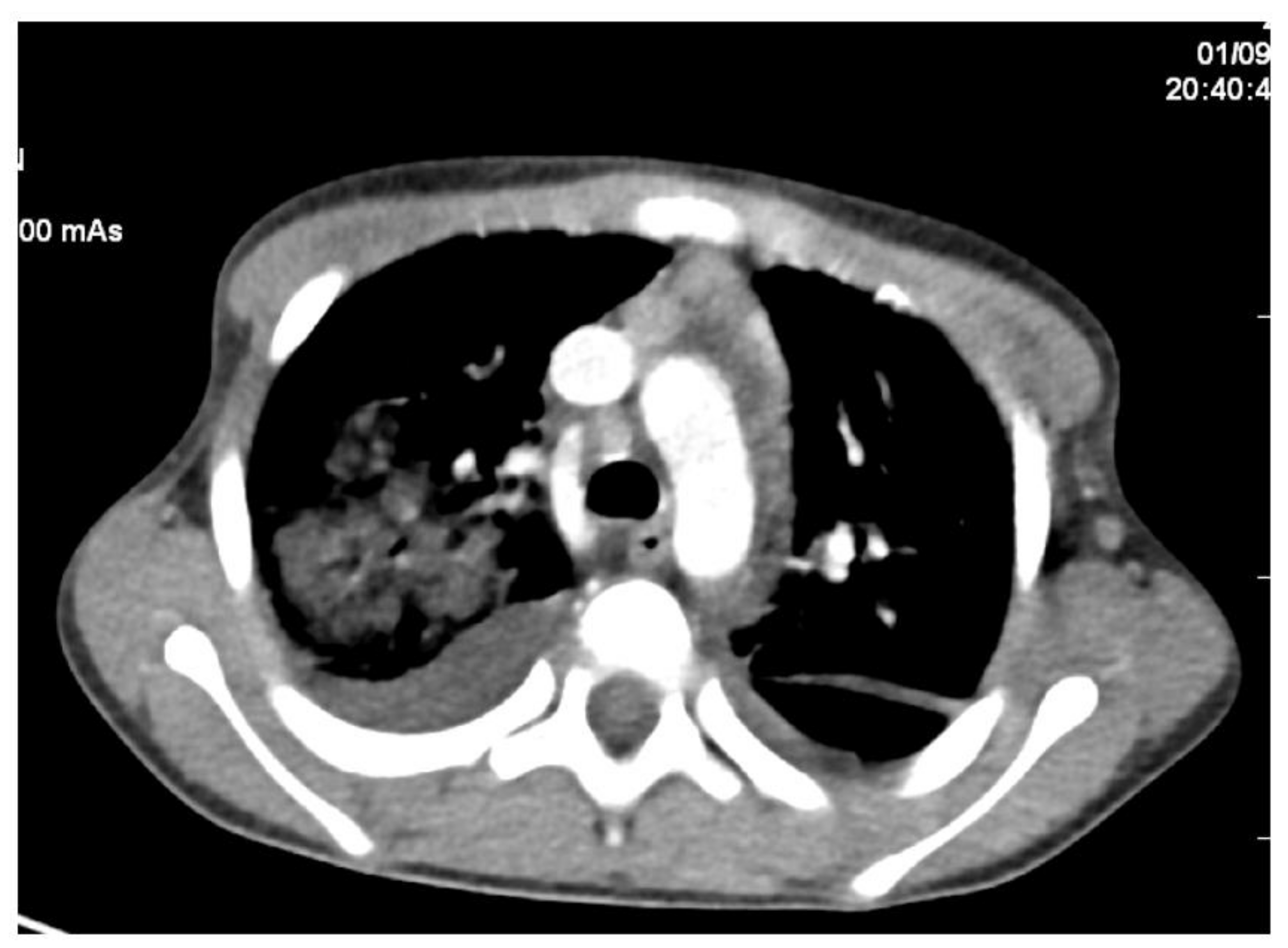 Diagnostics 12 00657 g008 Diagnostics 12 00657 g008