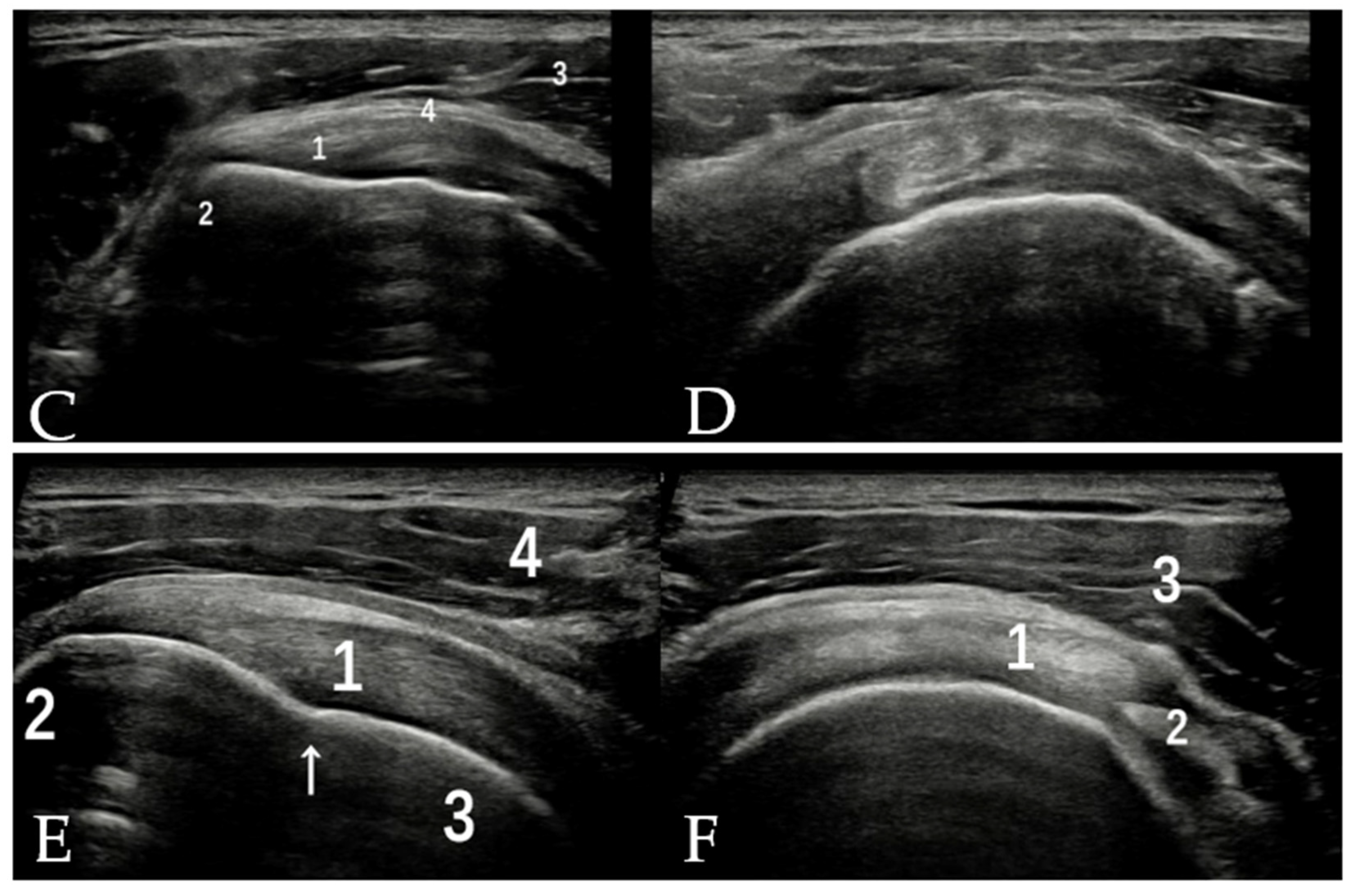 Diagnostics 12 00659 g004b