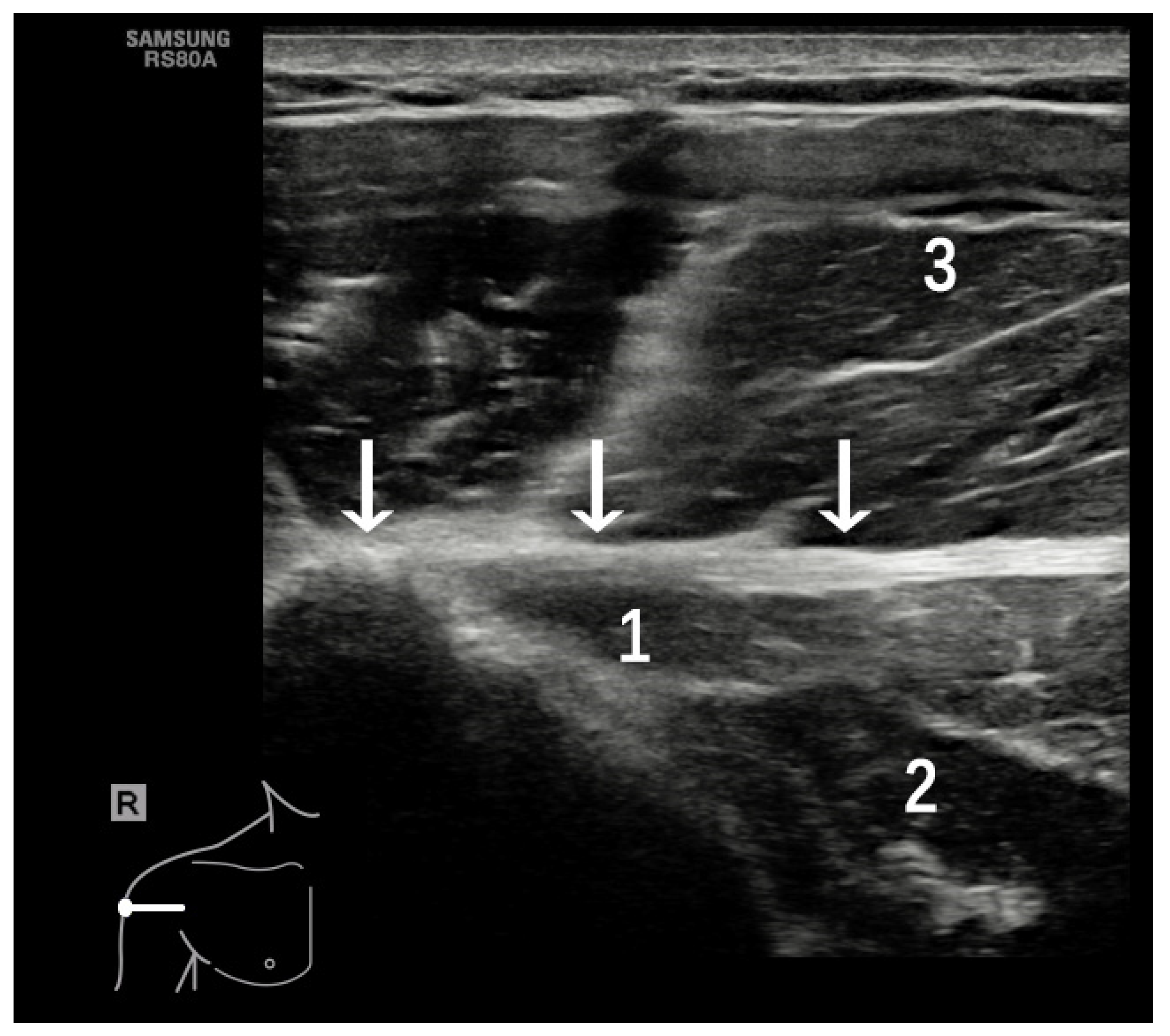 Diagnostics 12 00659 g005