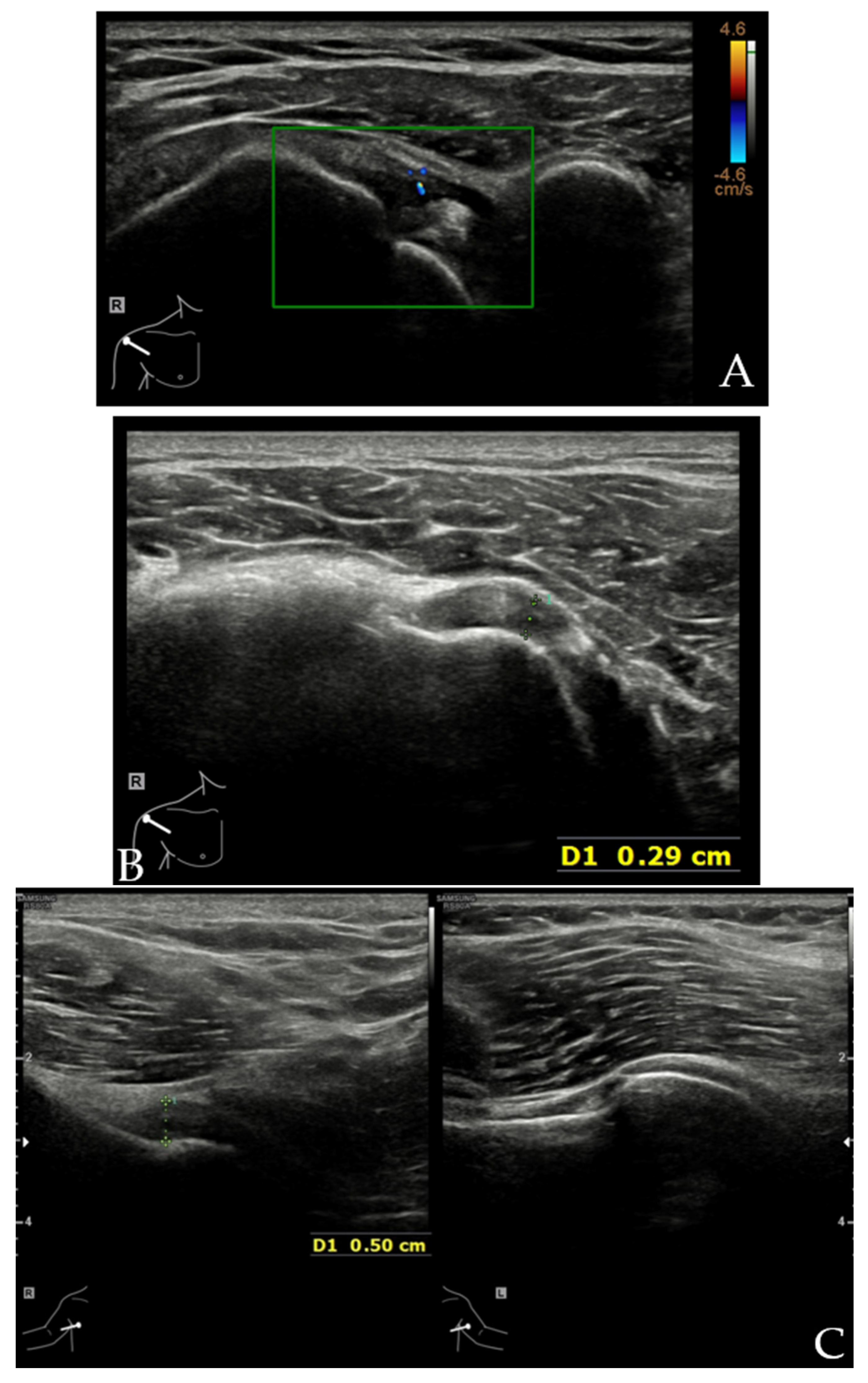 Diagnostics 12 00659 g008a