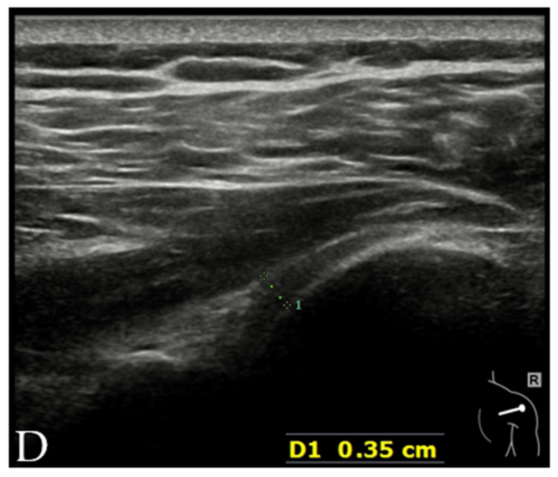 Diagnostics 12 00659 g008b