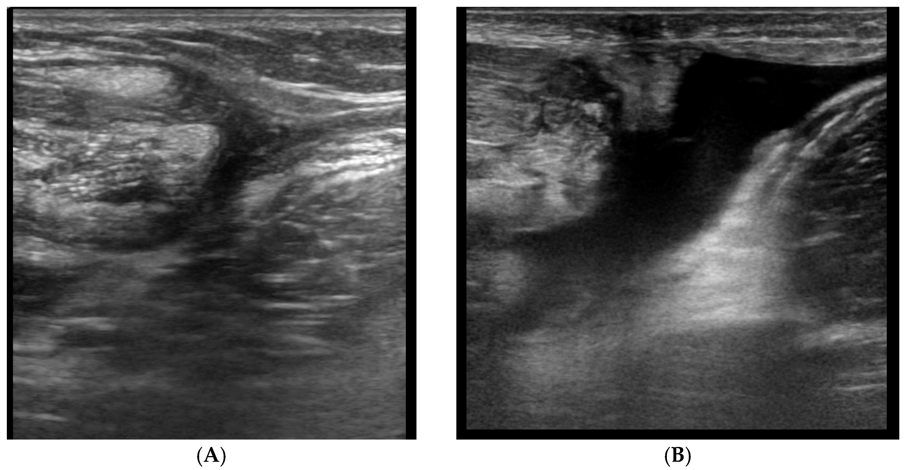 Diagnostics 12 00659 g010