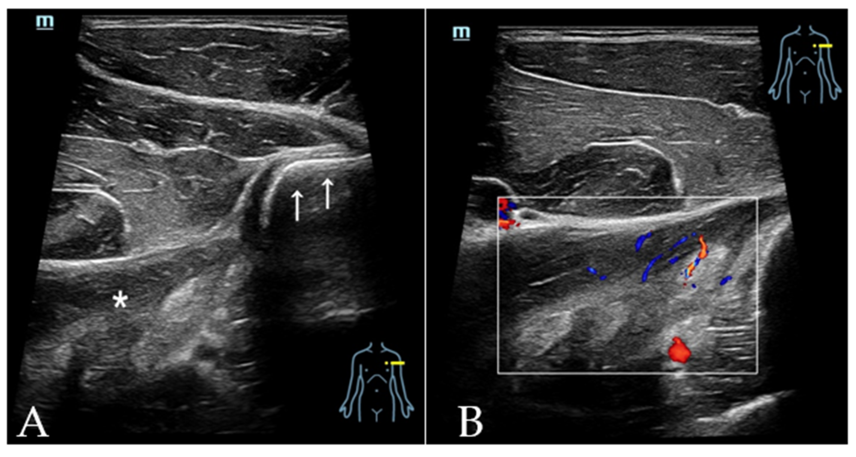 Diagnostics 12 00659 g011