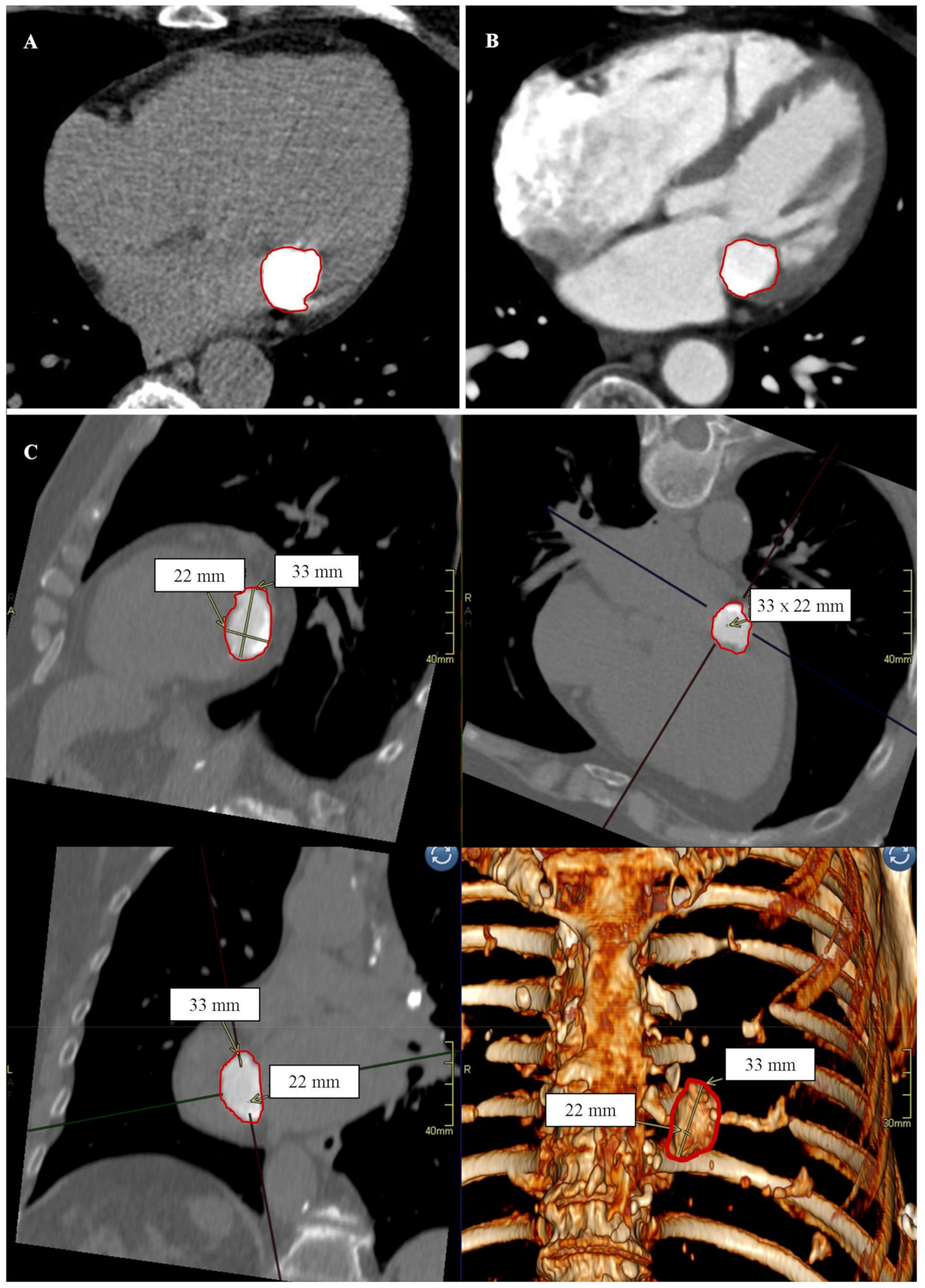 CRNA 510: Pathophysiology: Valvular Disease | ditki medical & biological  sciences