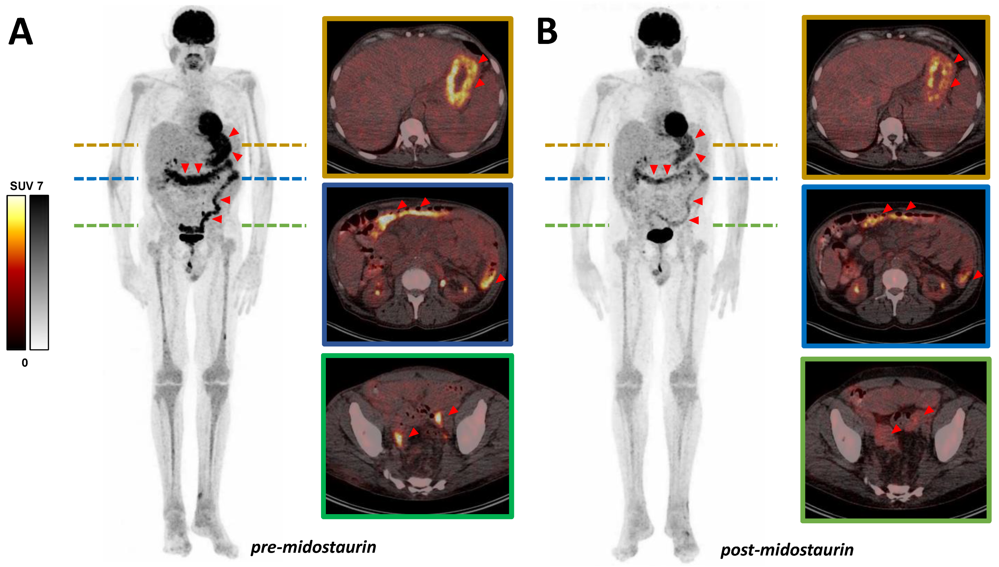 Diagnostics 12 00680 g001