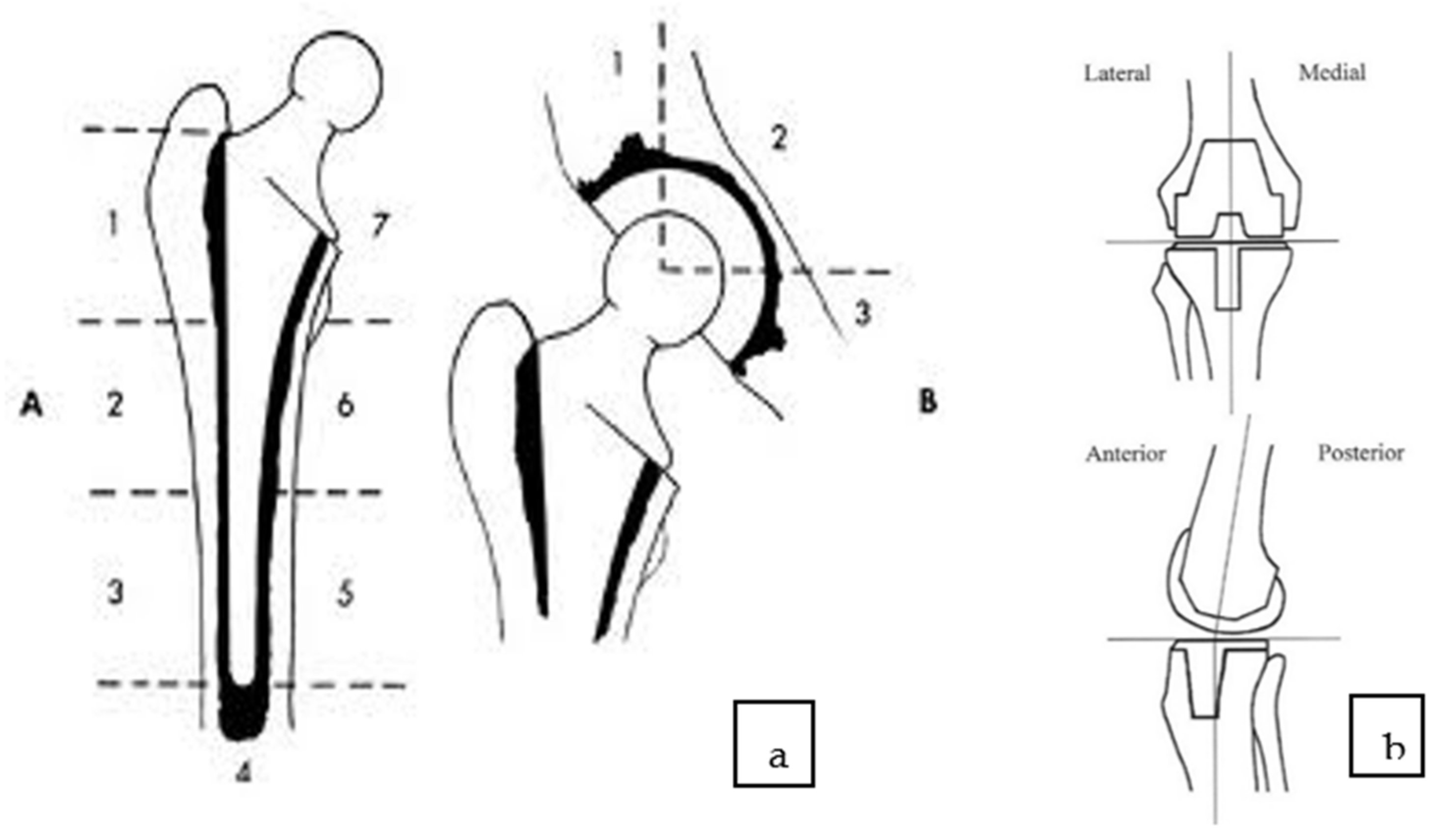 tumor u ramenom zglobu