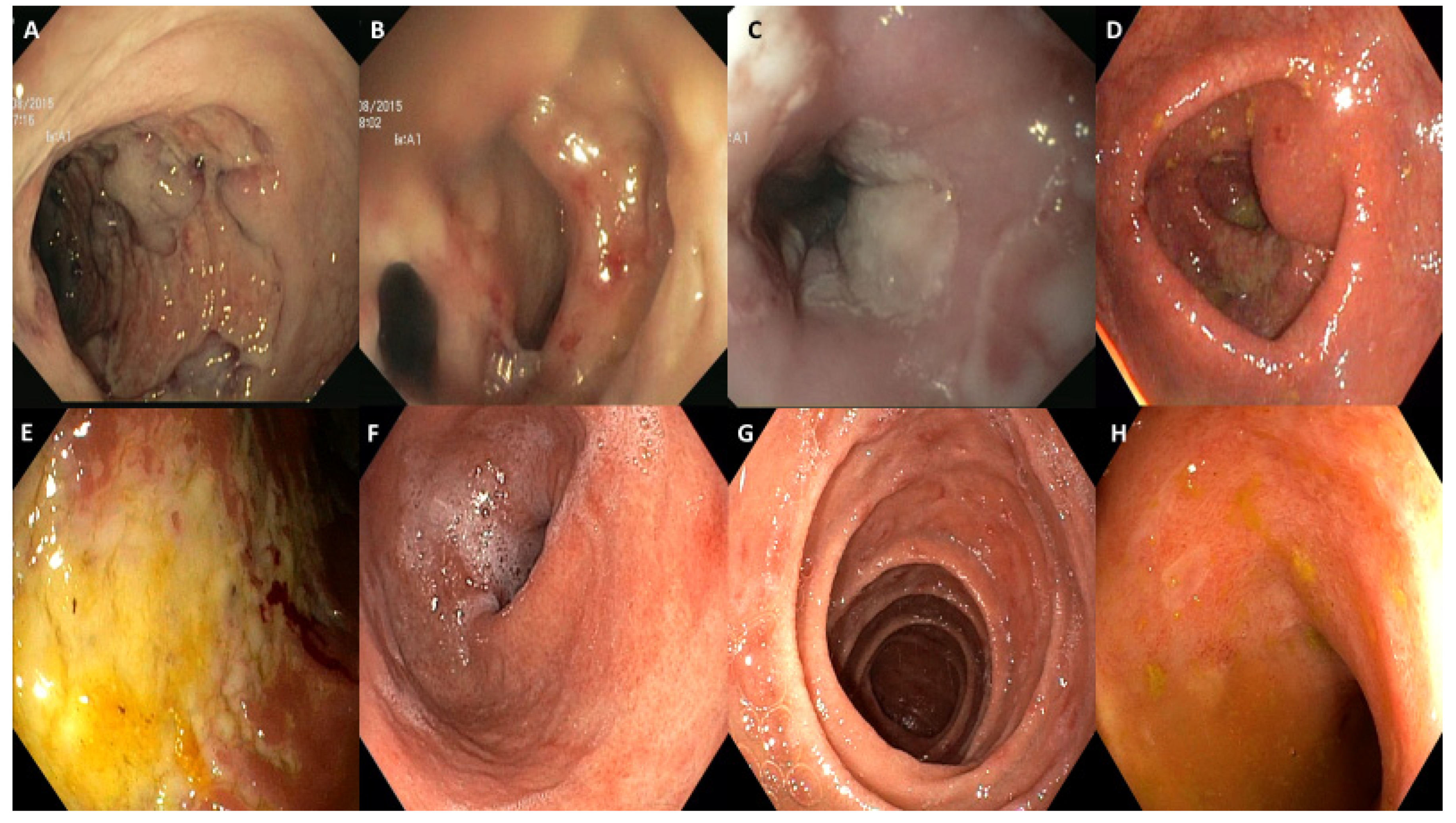 Diagnostics 12 00685 g001 550