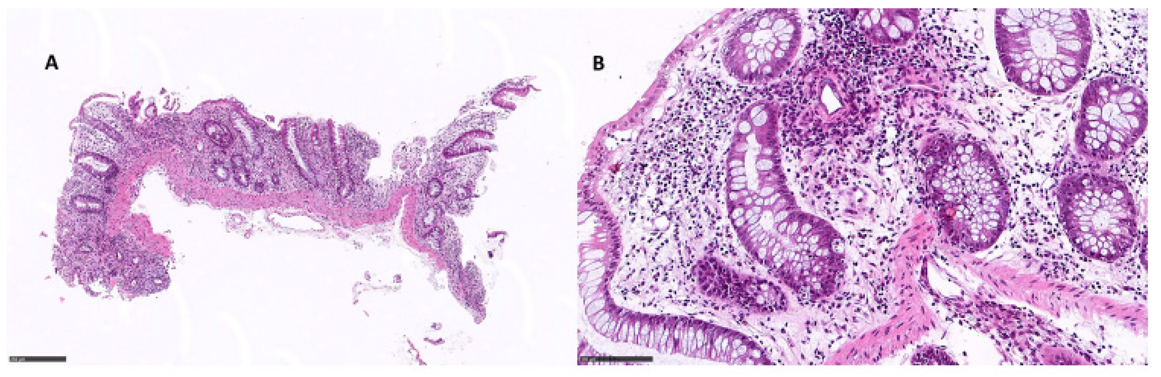 Diagnostics 12 00685 g002 550
