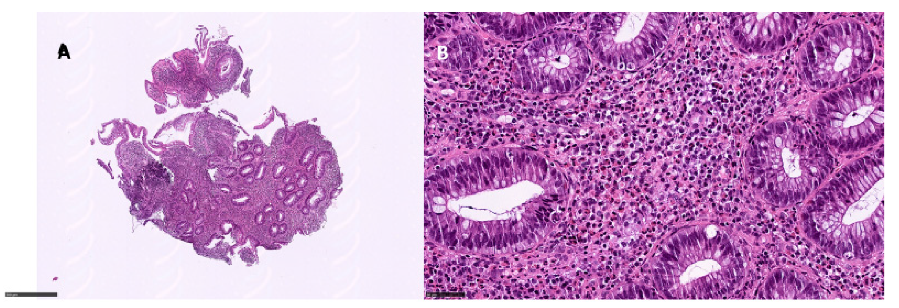 Diagnostics 12 00685 g003 550