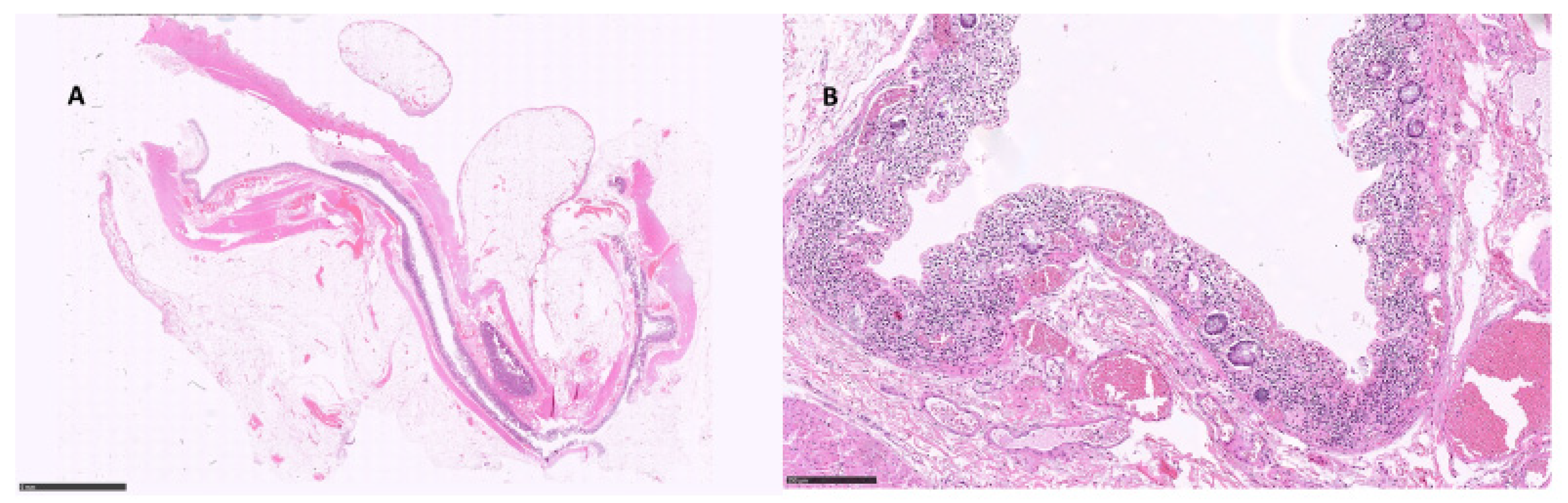 Diagnostics 12 00685 g004 550