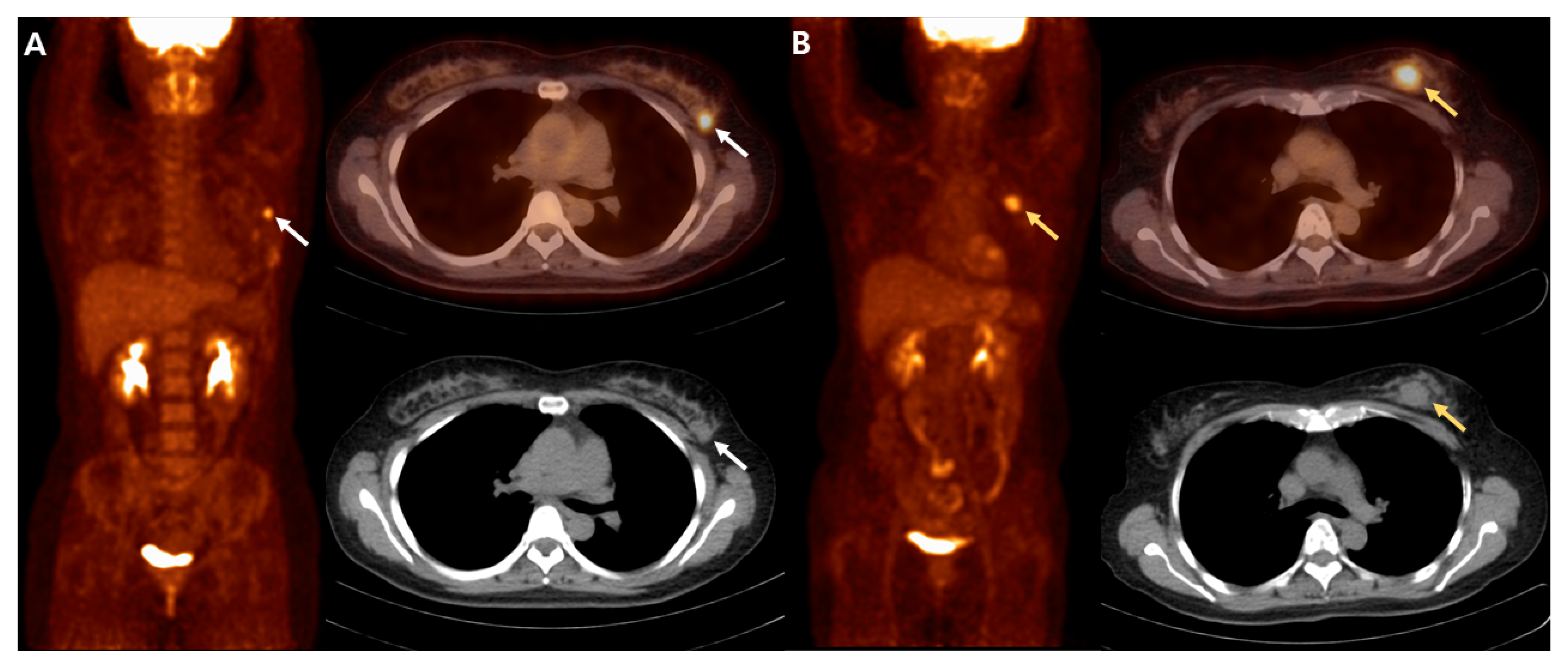 Diagnostics 12 00694 g002