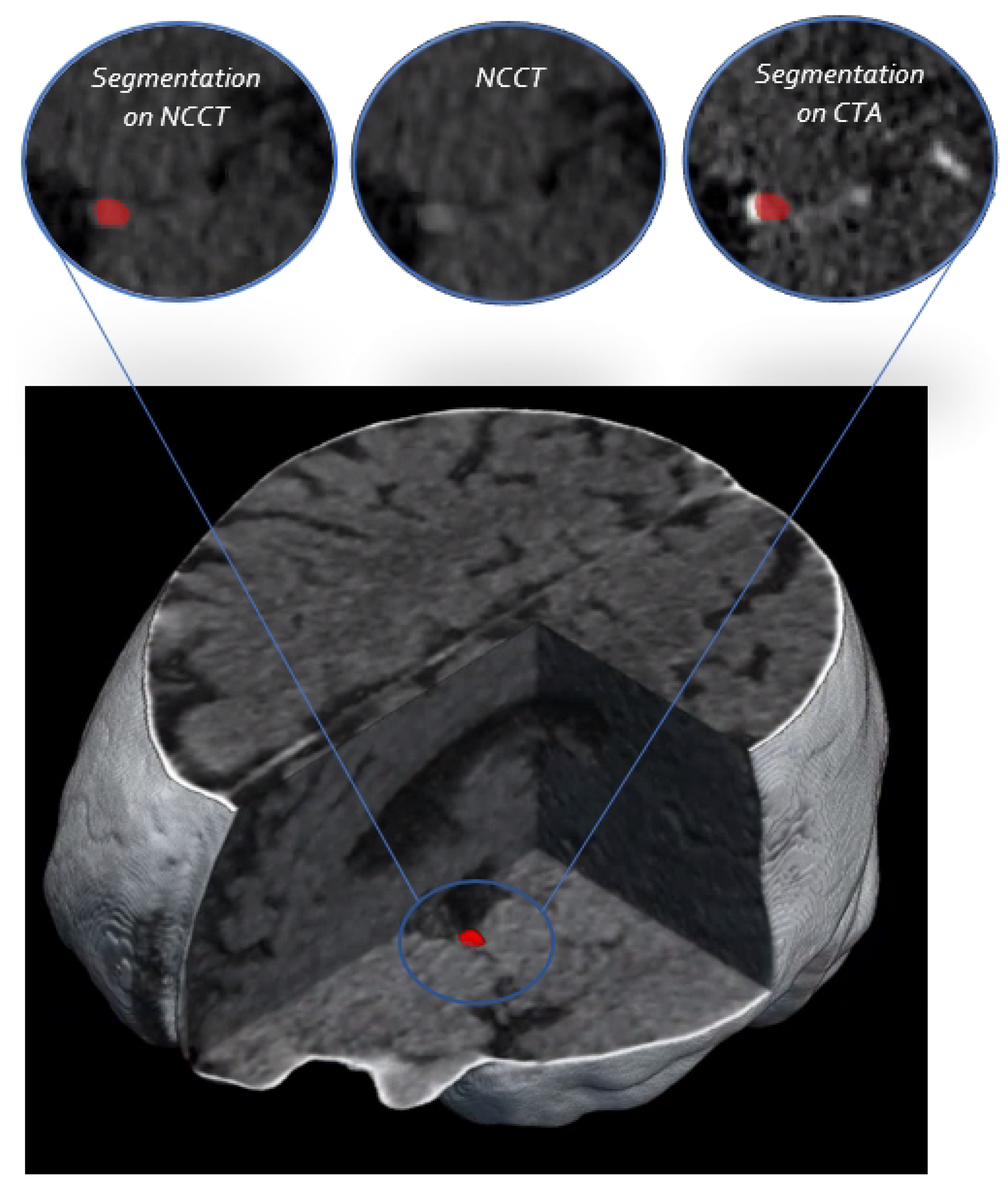Diagnostics 12 00698 g005 Diagnostics 12 00698 g005