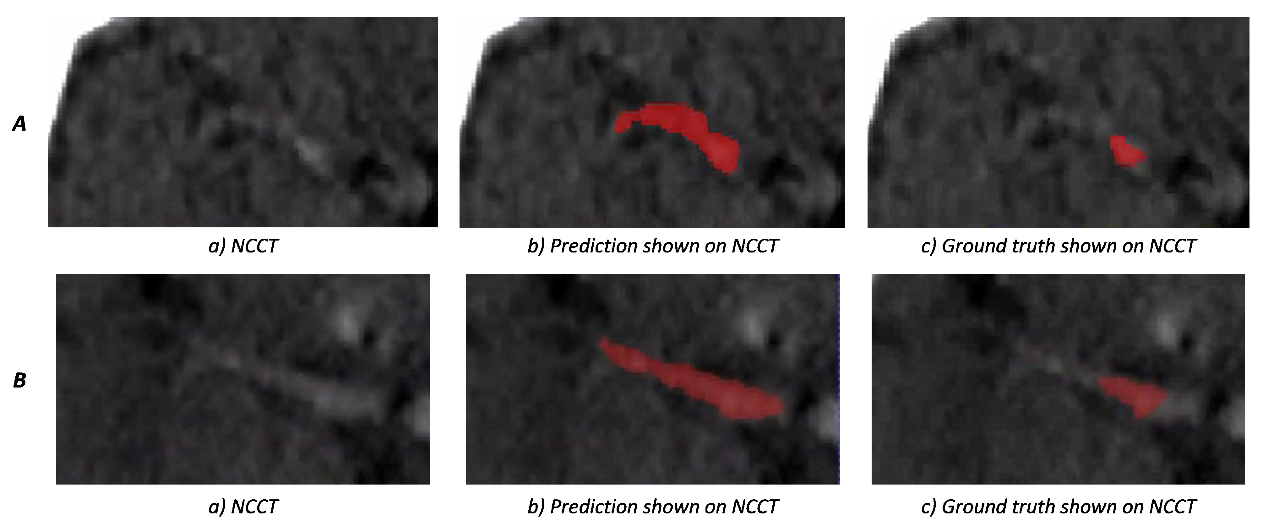 Diagnostics 12 00698 g008 Diagnostics 12 00698 g008