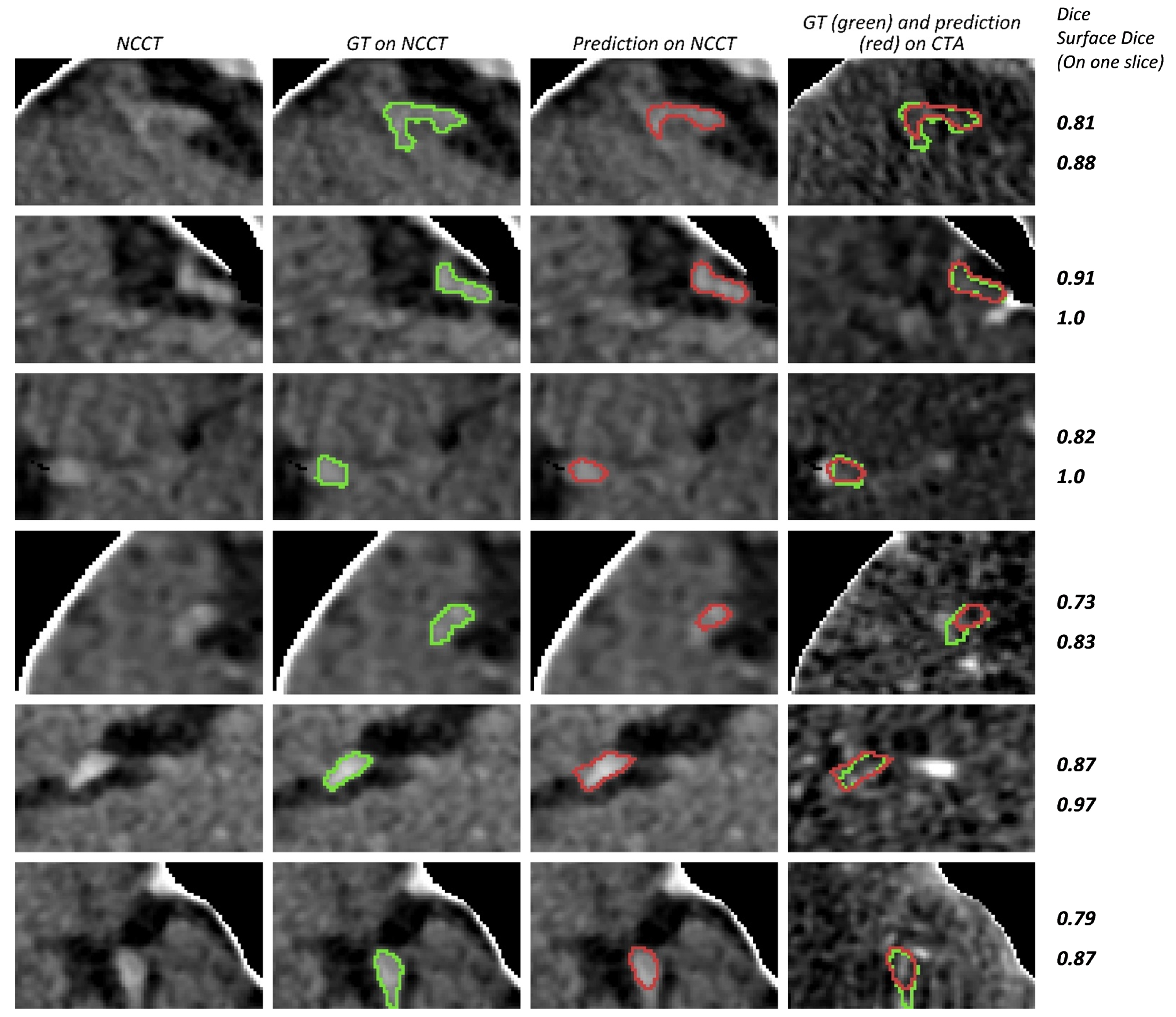 Diagnostics 12 00698 g009 Diagnostics 12 00698 g009
