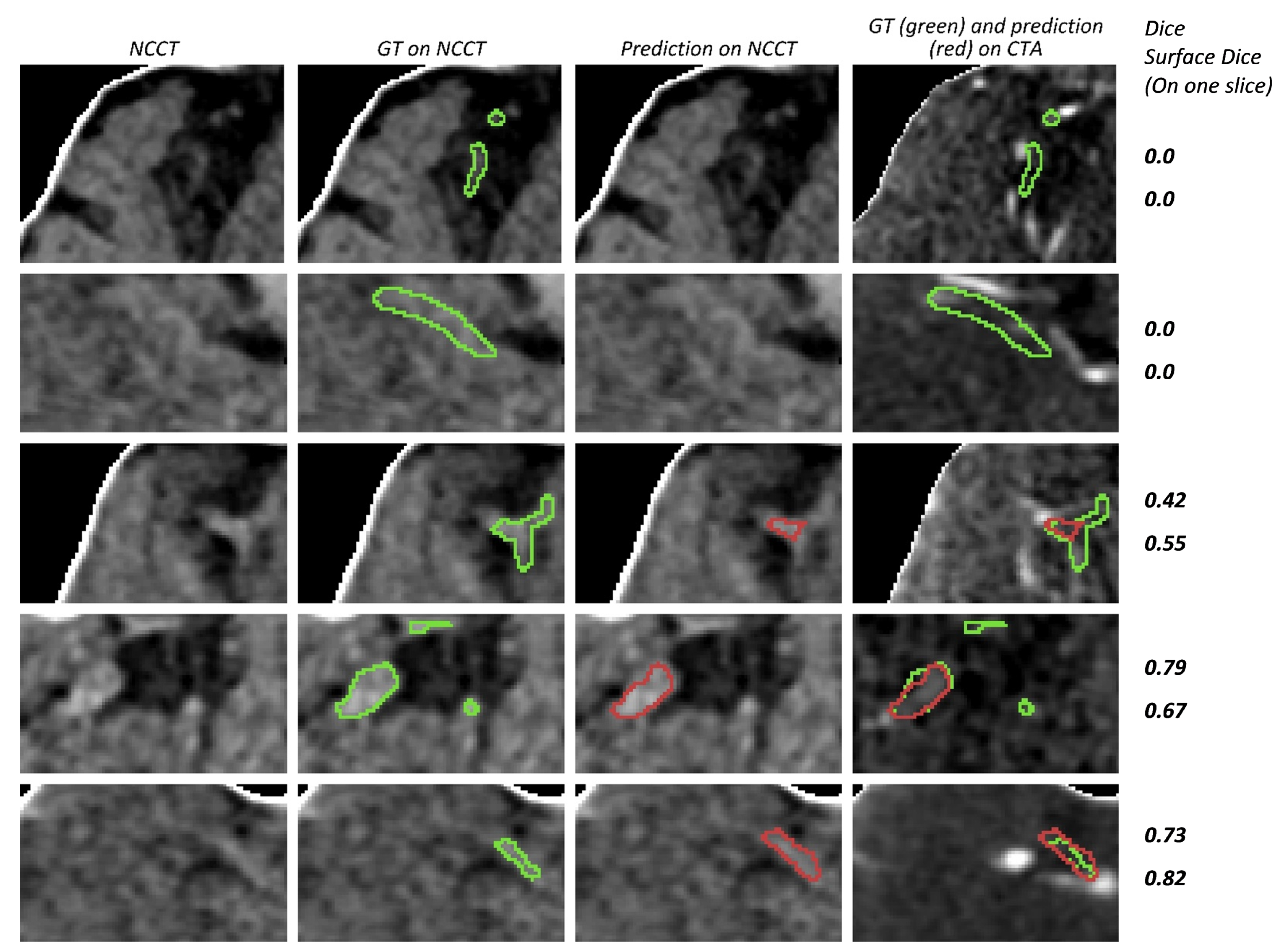 Diagnostics 12 00698 g010 Diagnostics 12 00698 g010