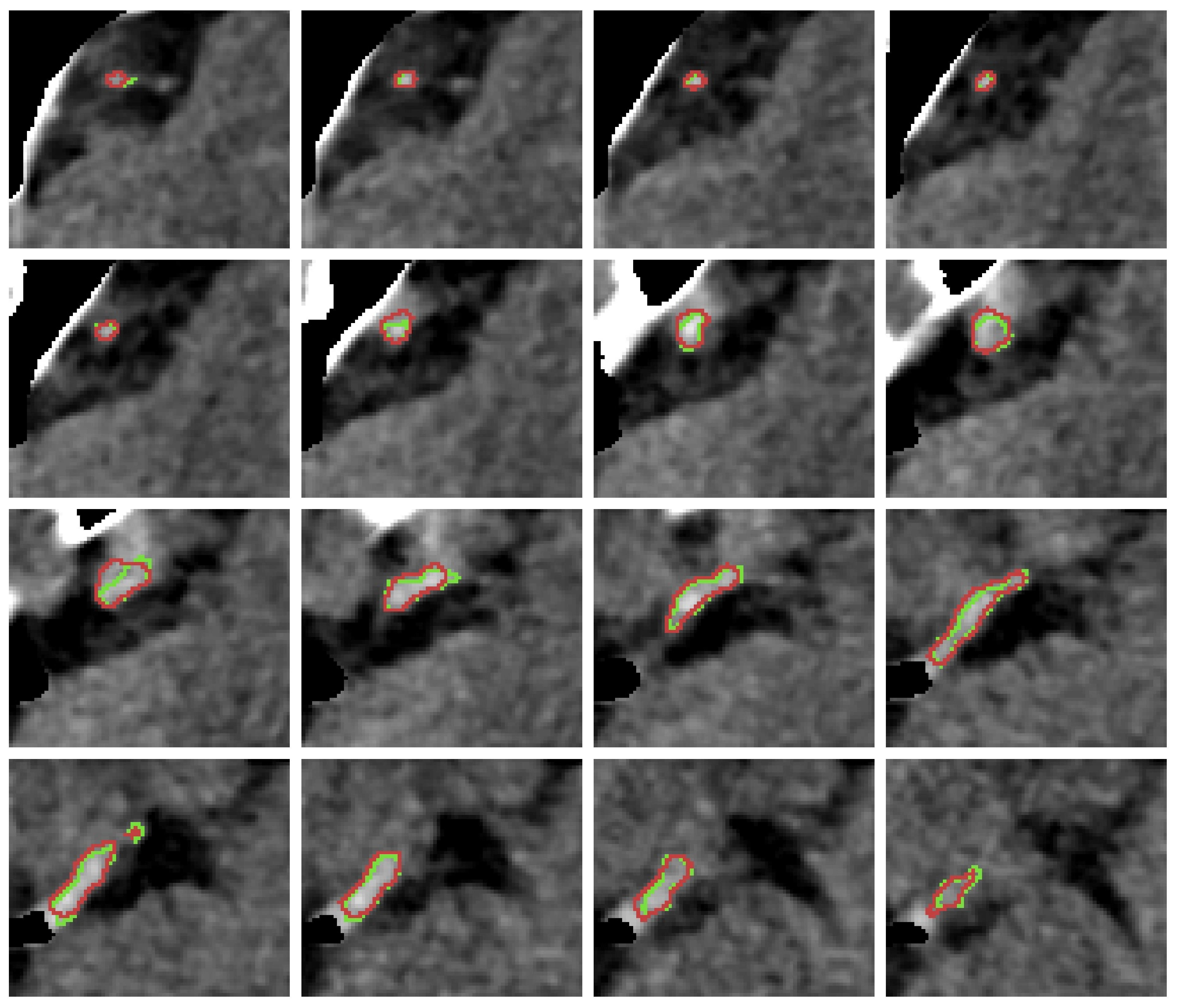 Diagnostics 12 00698 g0a3 Diagnostics 12 00698 g0a3
